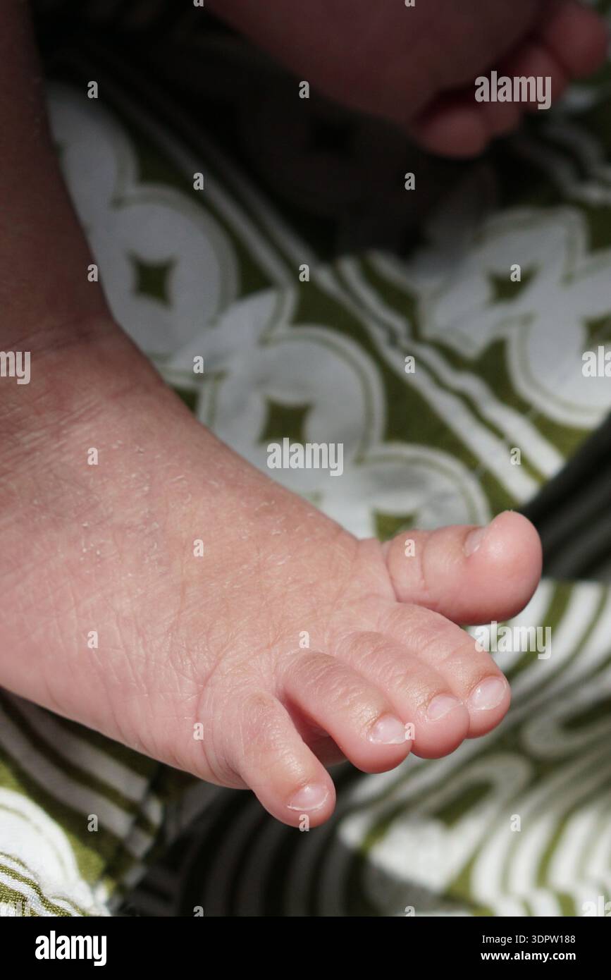 Hi Resolution Toes Infant toes hi-res stock photography and images - Alamy