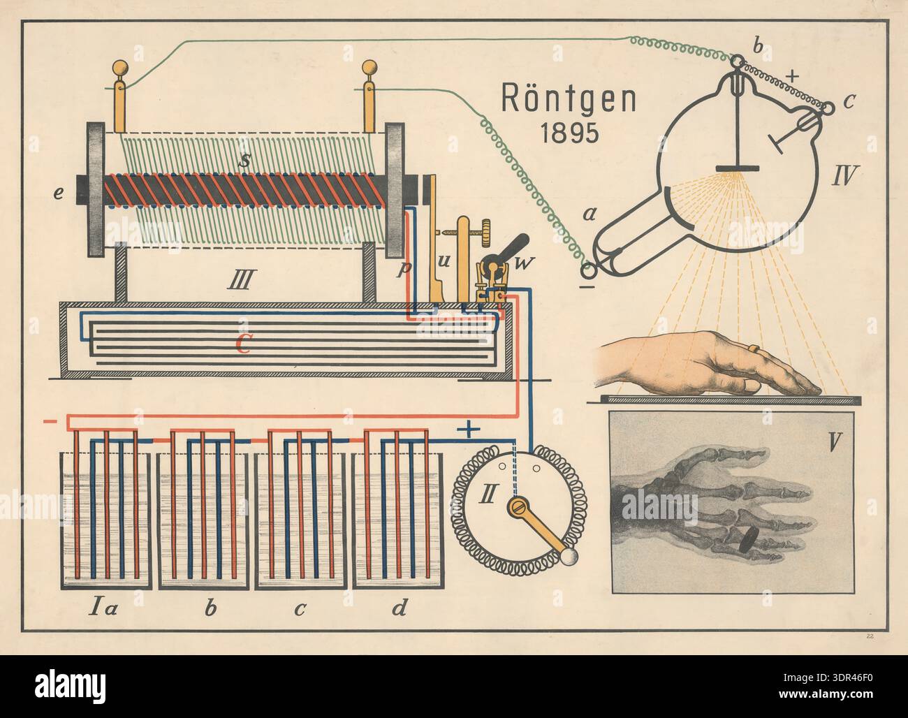 The image shows the first X-ray of a human hand, taken by Wilhelm ...