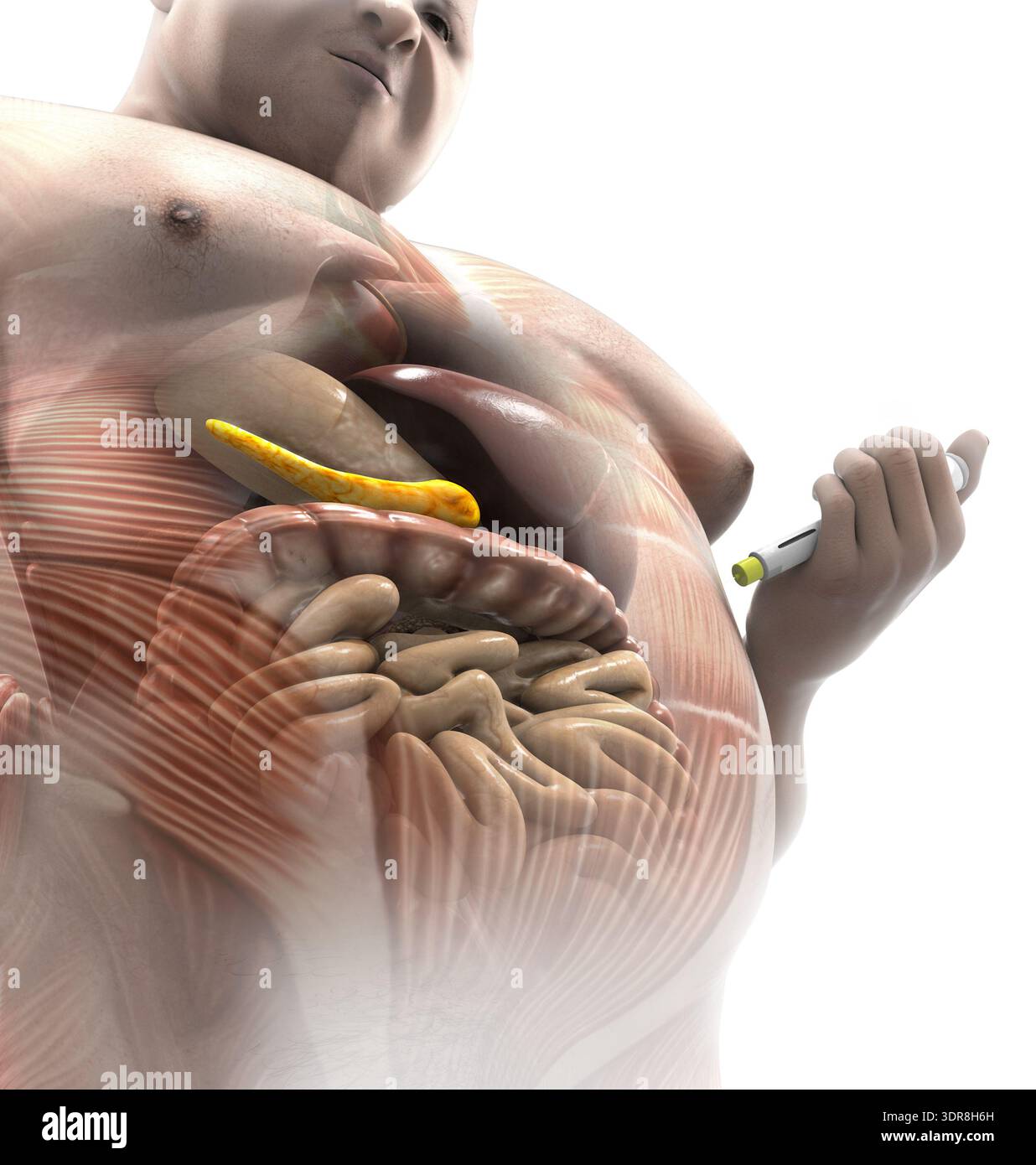 where is the best place to inject a glp 1 Here's How To Properly Inject GLP-1 Weight Loss Medications