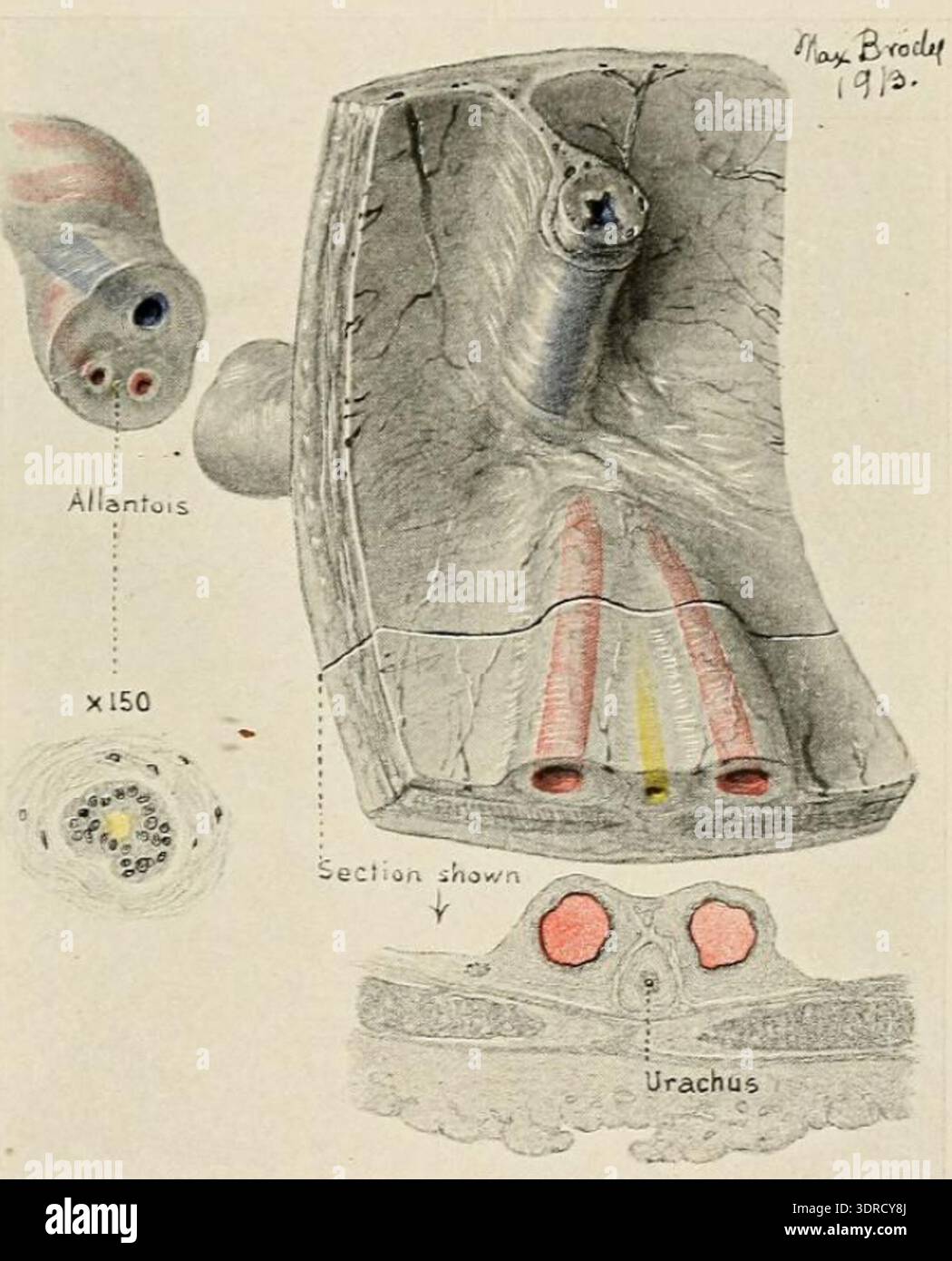 this-1916-illustration-by-thomas-stephen-cullen-shows-an-extra-abdominal-view-of-a-12-cm-human-embryos-umbilical-region-the-urachus-is-narrow-with-segments-of-the-allantois-showing-lumens-lined-by-polygonal-cells-the-umbilical-ring-is-completely-closed-external-views-of-the-region-document-connective-tissue-subcutaneous-fat-and-vascular-arrangements-providing-reference-for-embryonic-anatomy-development-and-tissue-morphology-3DRCY8J.jpg