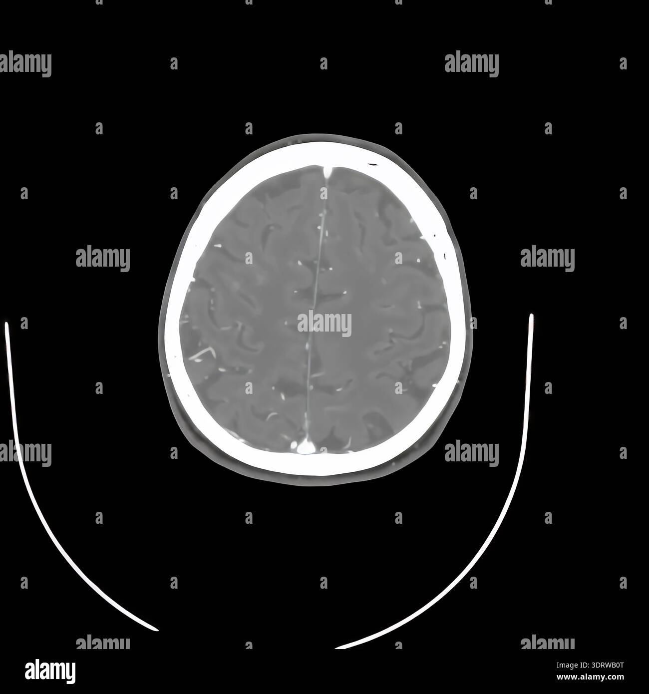 Human head CT scan on a black background displaying internal anatomy including brain, eyes, and skull structure, providing detailed medical imaging fo Stock Photo