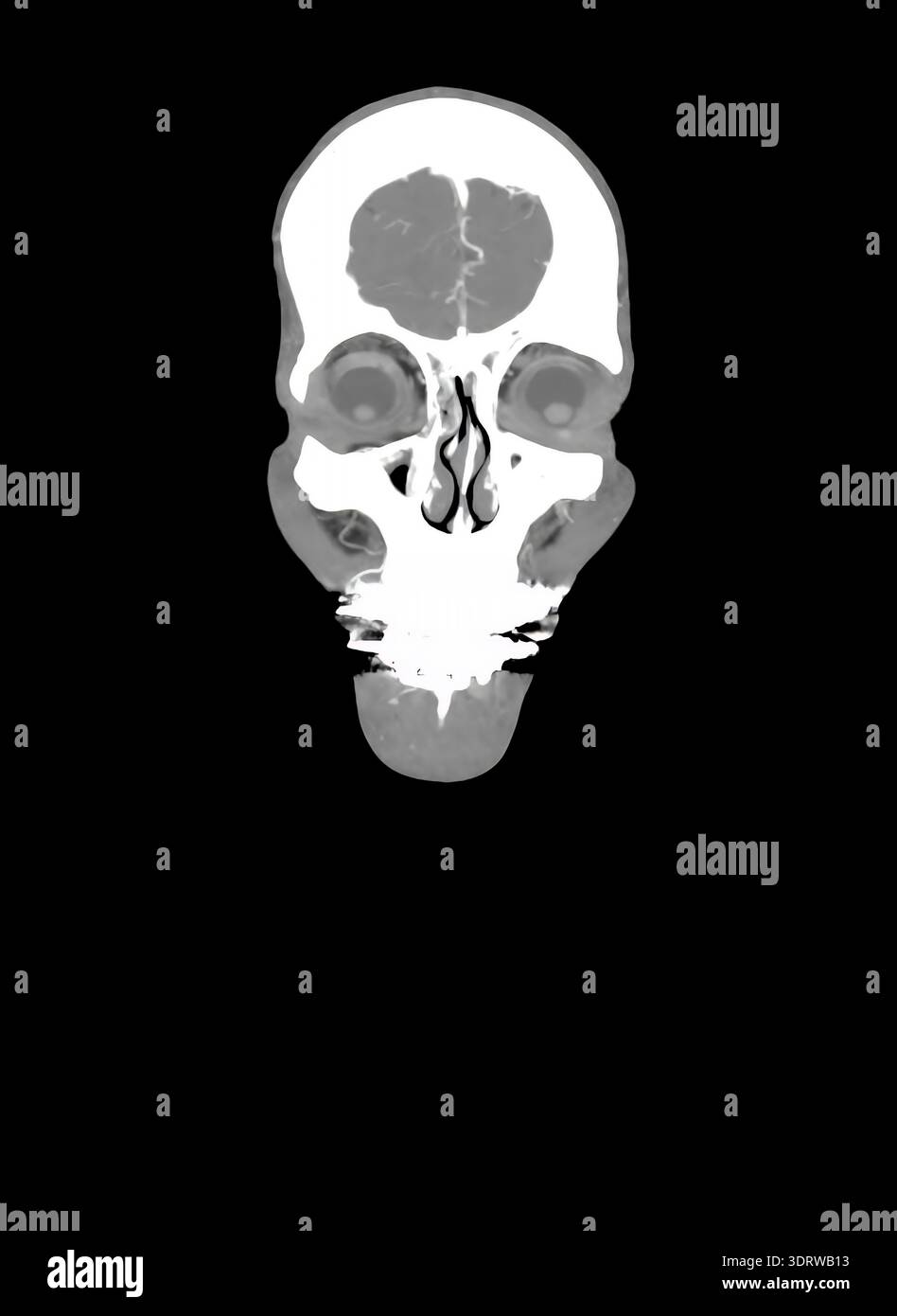 3d ct scan head neck hi-res stock photography and images - Alamy