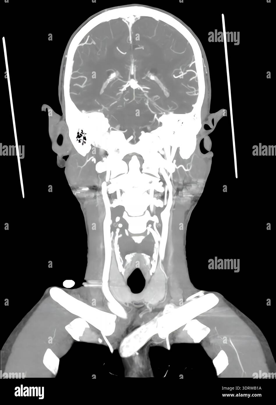 3d ct scan head neck hi-res stock photography and images - Alamy