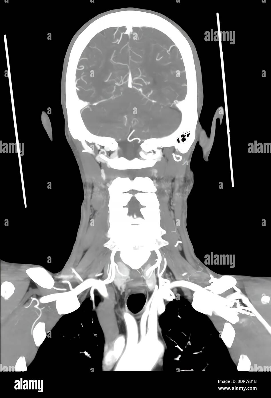 3d ct scan head neck hi-res stock photography and images - Alamy