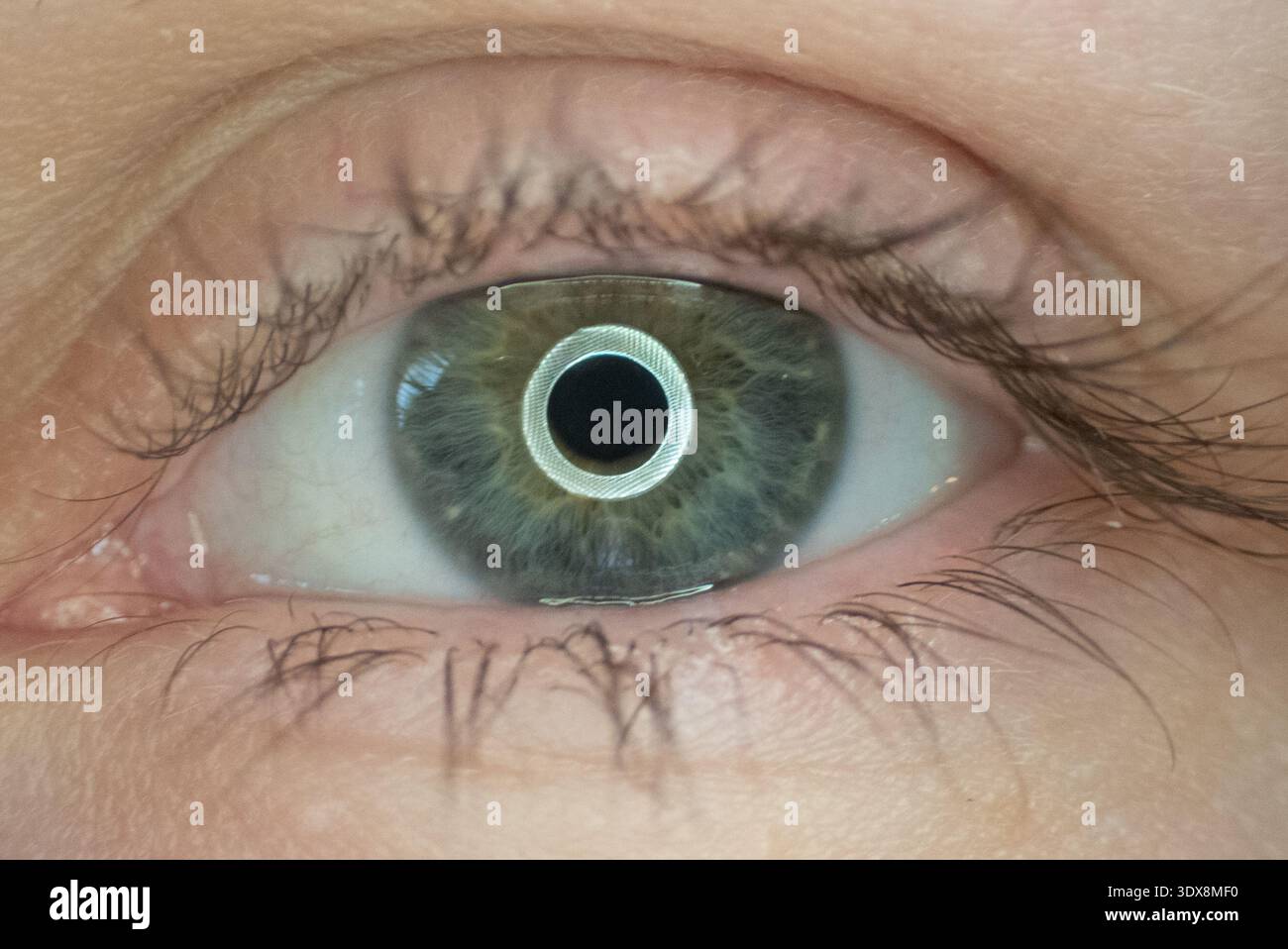 Human eye anatomy sight hi-res stock photography and images - Alamy