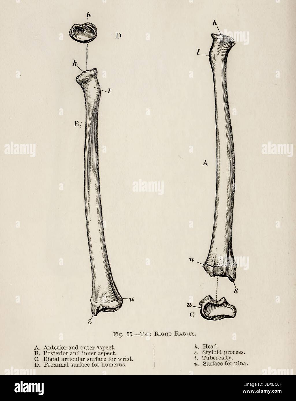 Radius With Labels Anatomical illustration of the right radius, showing different aspects ...