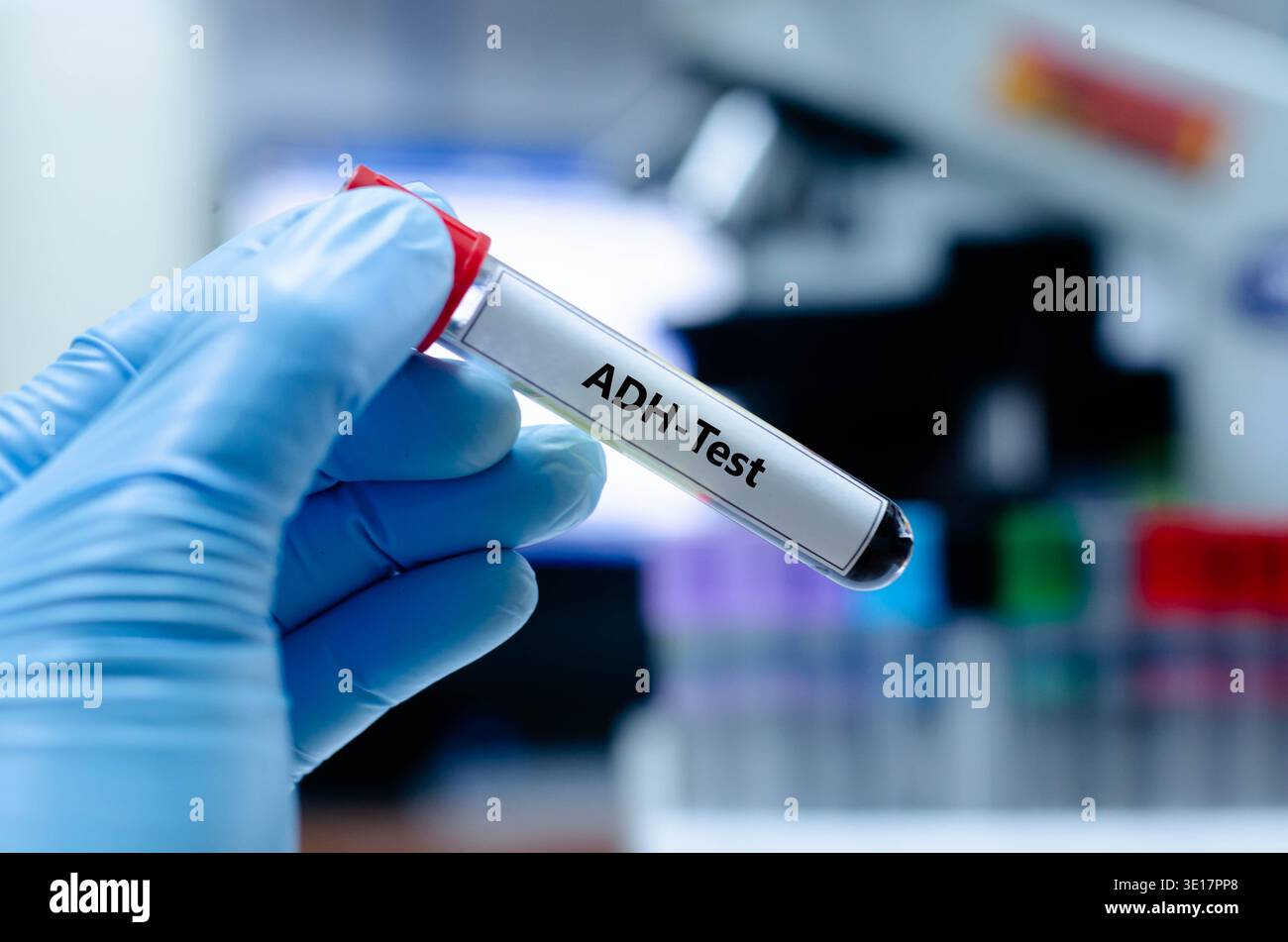 Blood sample tube for ADH test analysis Stock Photo - Alamy