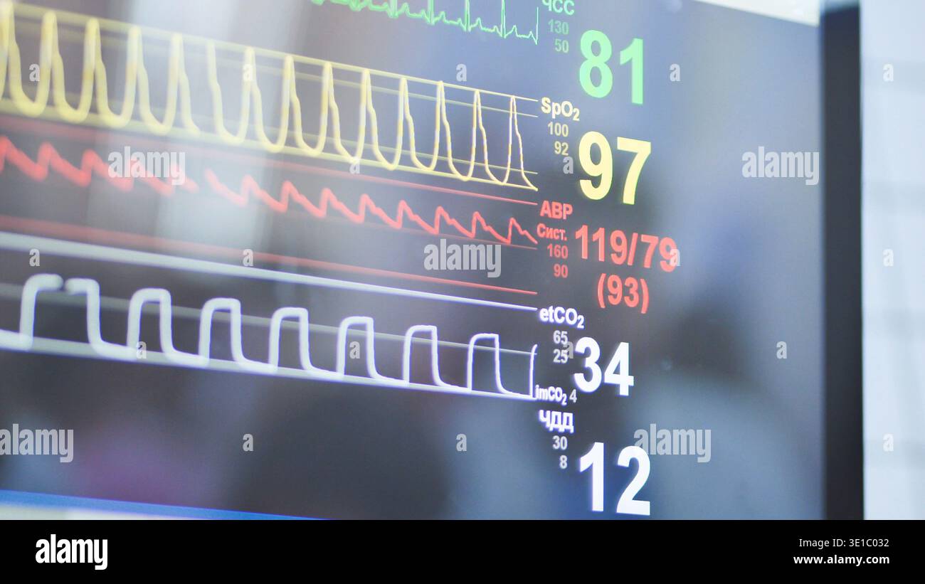 Patient vital signs monitor showing heart rate, oxygen saturation, and ...