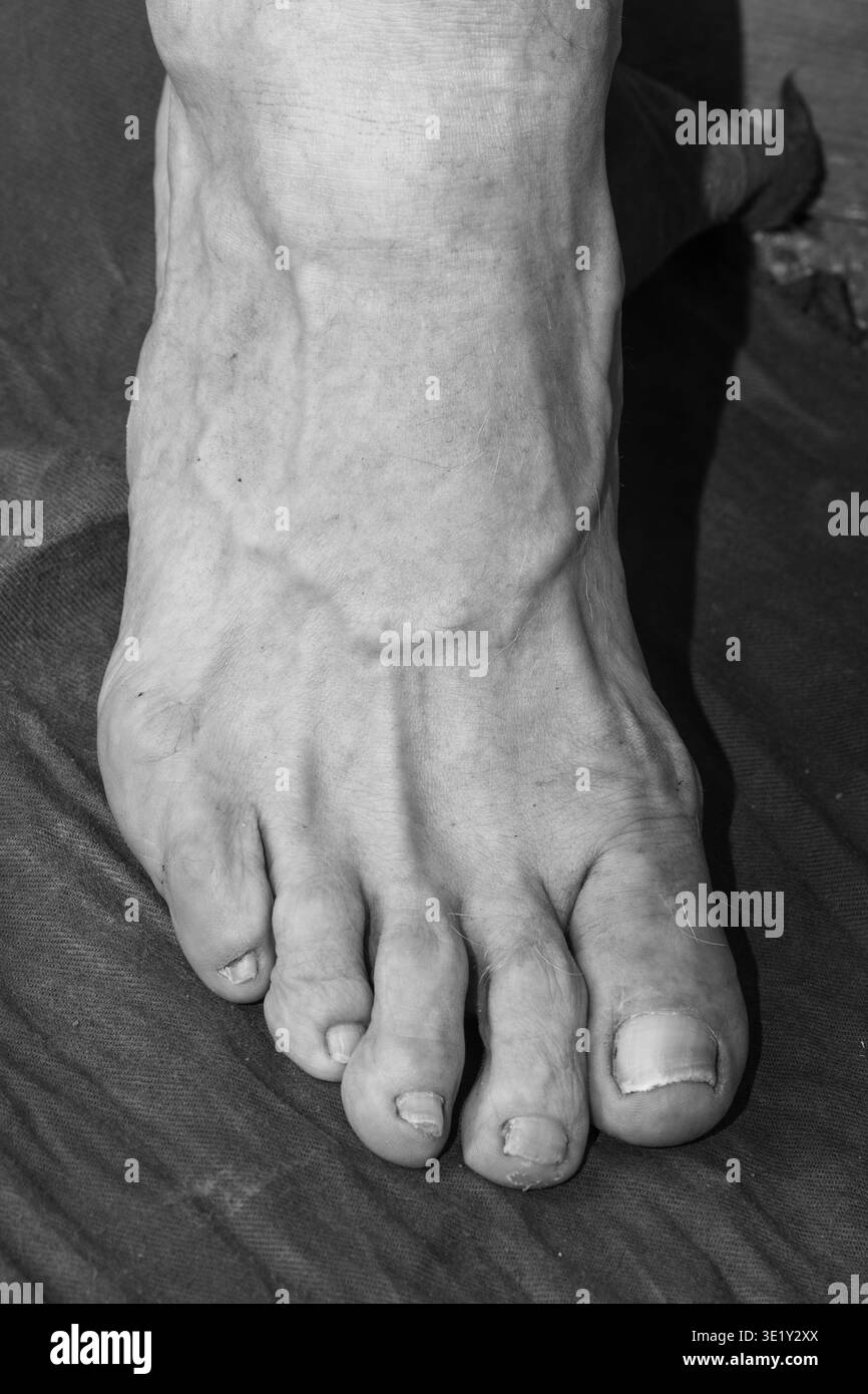 Normal Toes Human Close-up view of a human foot highlighting the structure of toes and ...