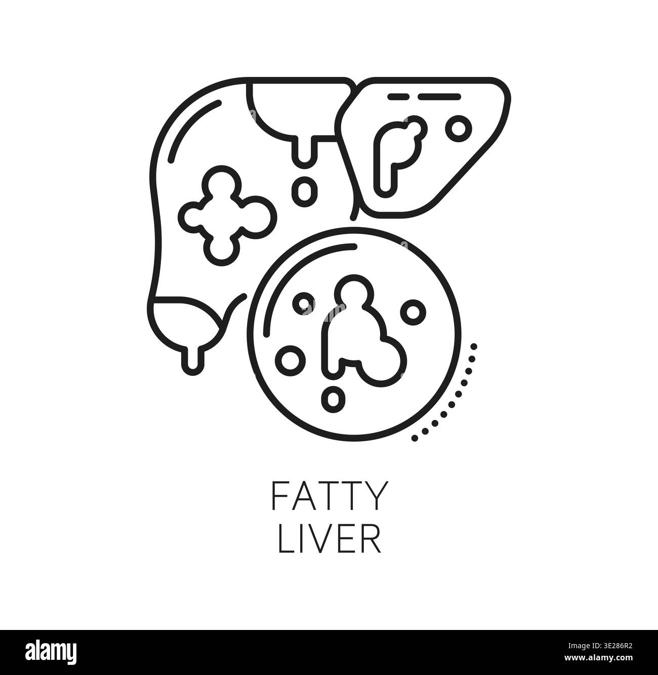 Chronic liver disease and therapy, medical line icon. Human liver with ...