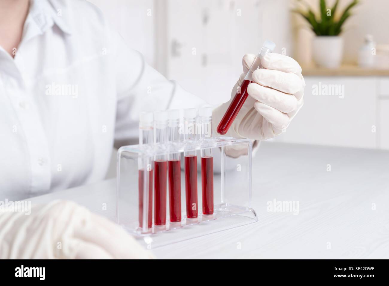 Medical worker holding blood sample above test tube rack, laboratory workflow and clinical diagnostics concept in modern healthcare environment Stock Photo