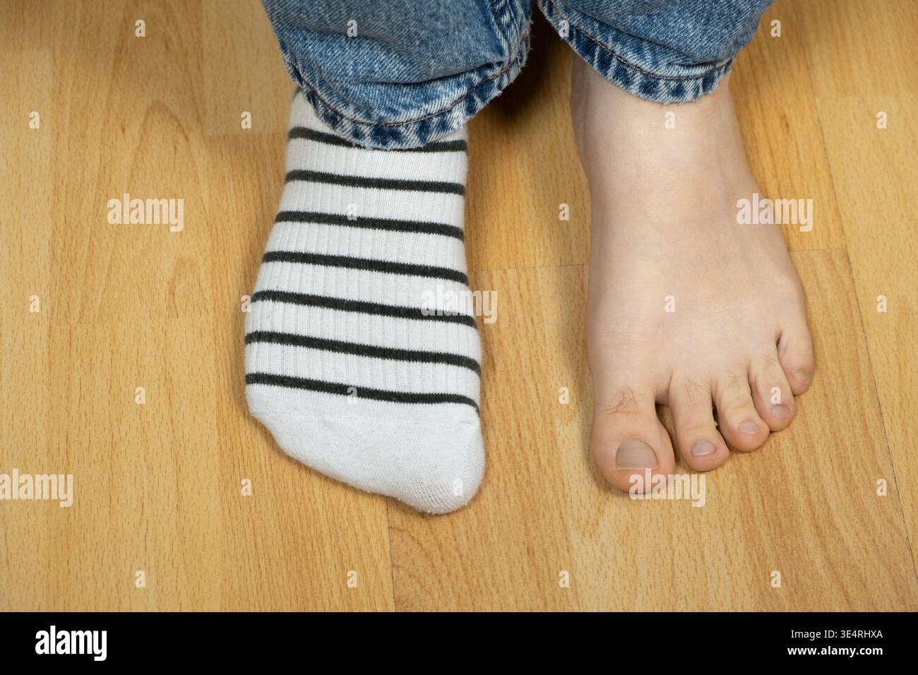Comparison of womens feet with and without socks. Selection of comfortable socks for foot health Stock Photo