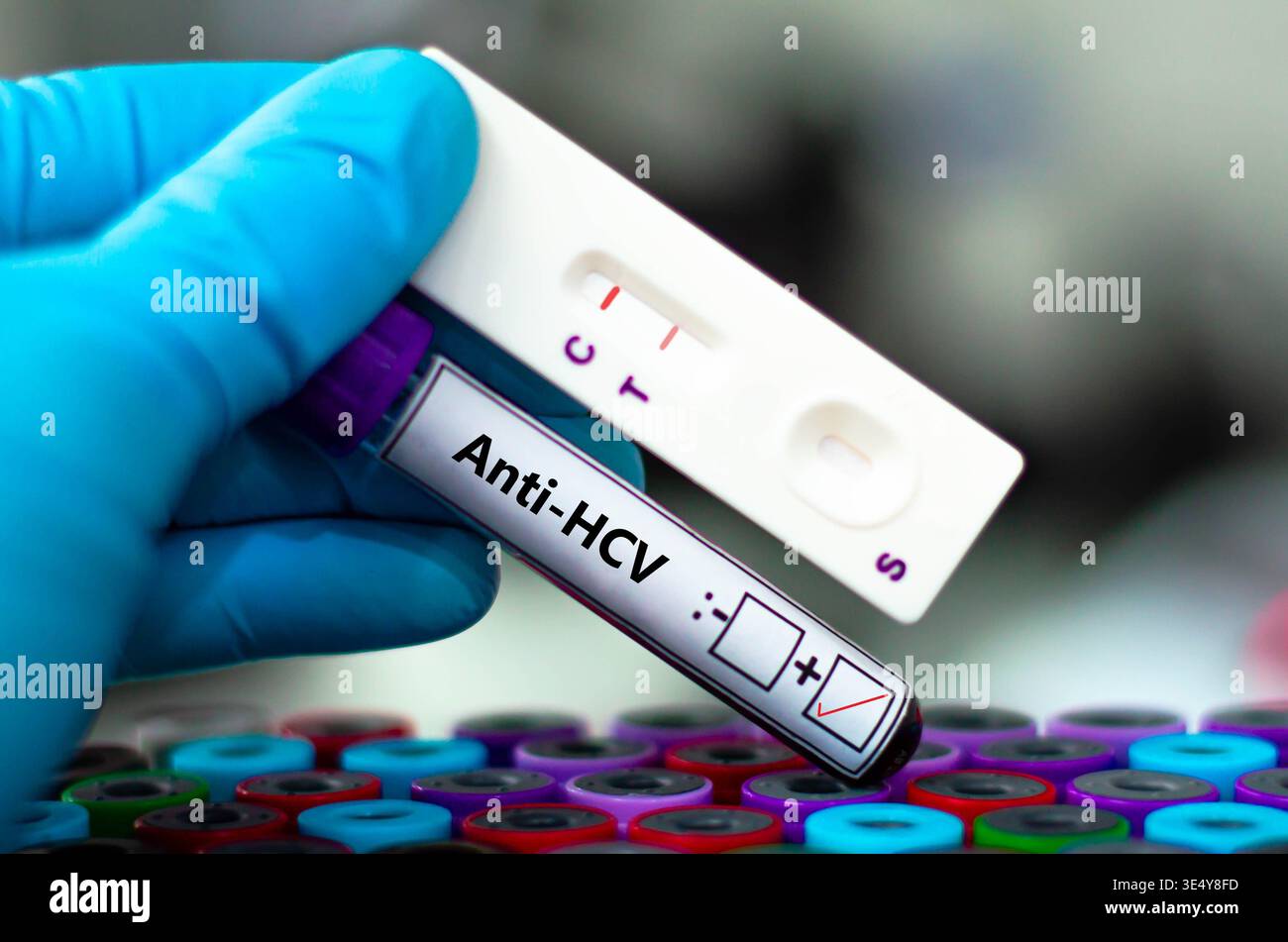 Blood sample tube of patient positive result for anti-HCV Stock Photo ...