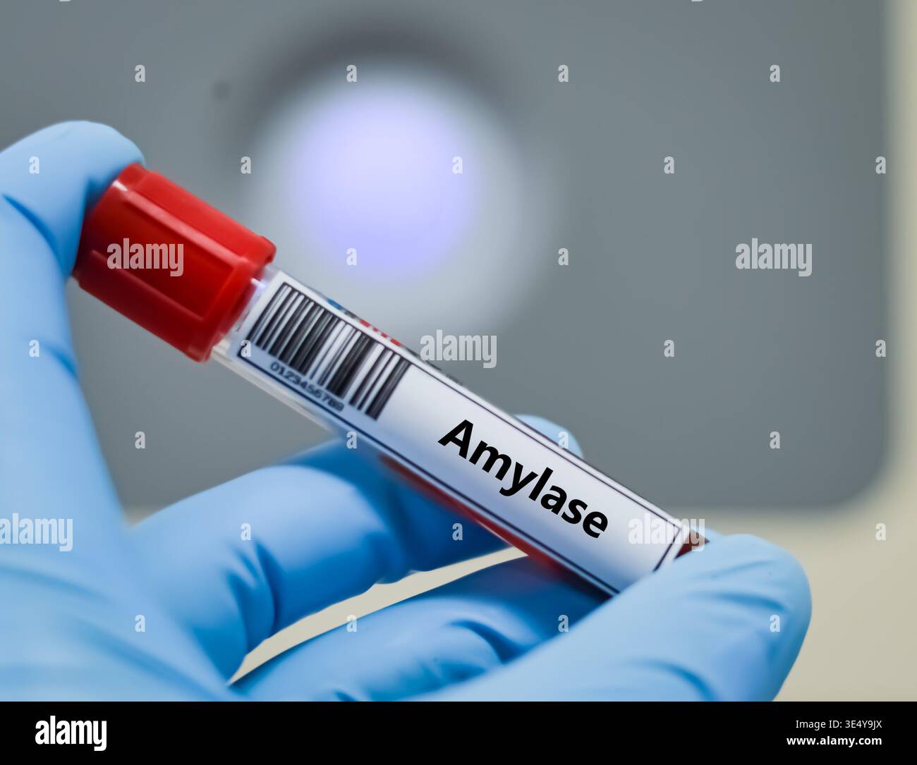 Blood sample tube for amylase test analysis Stock Photo - Alamy