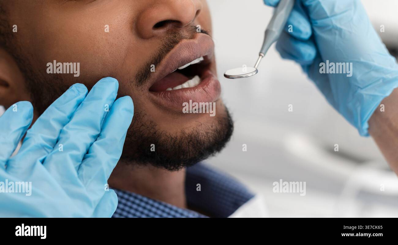 Black male patient getting his teeth checked by female dentist wearing gloves in clinic Stock Photo