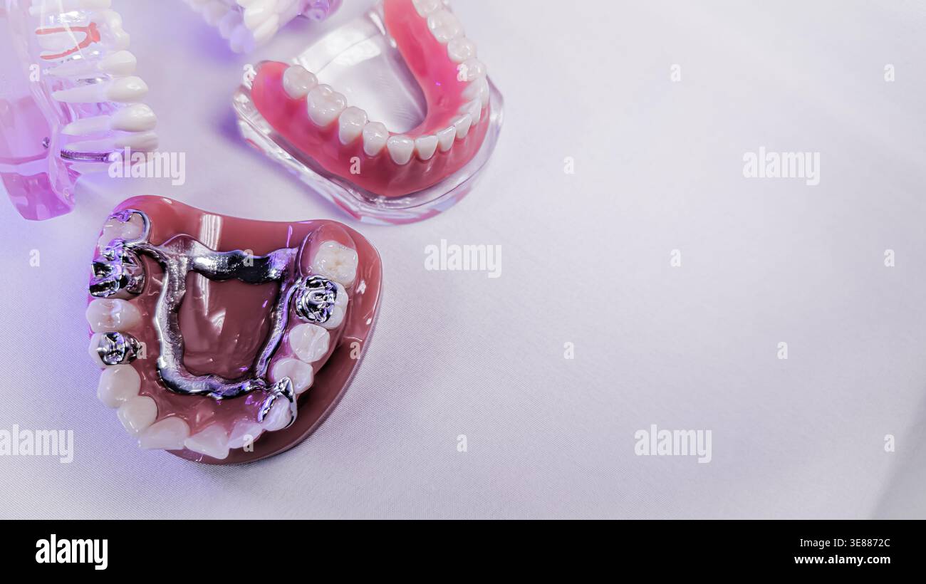 Upper jaw model with removable denture and copy space on white background Stock Photo