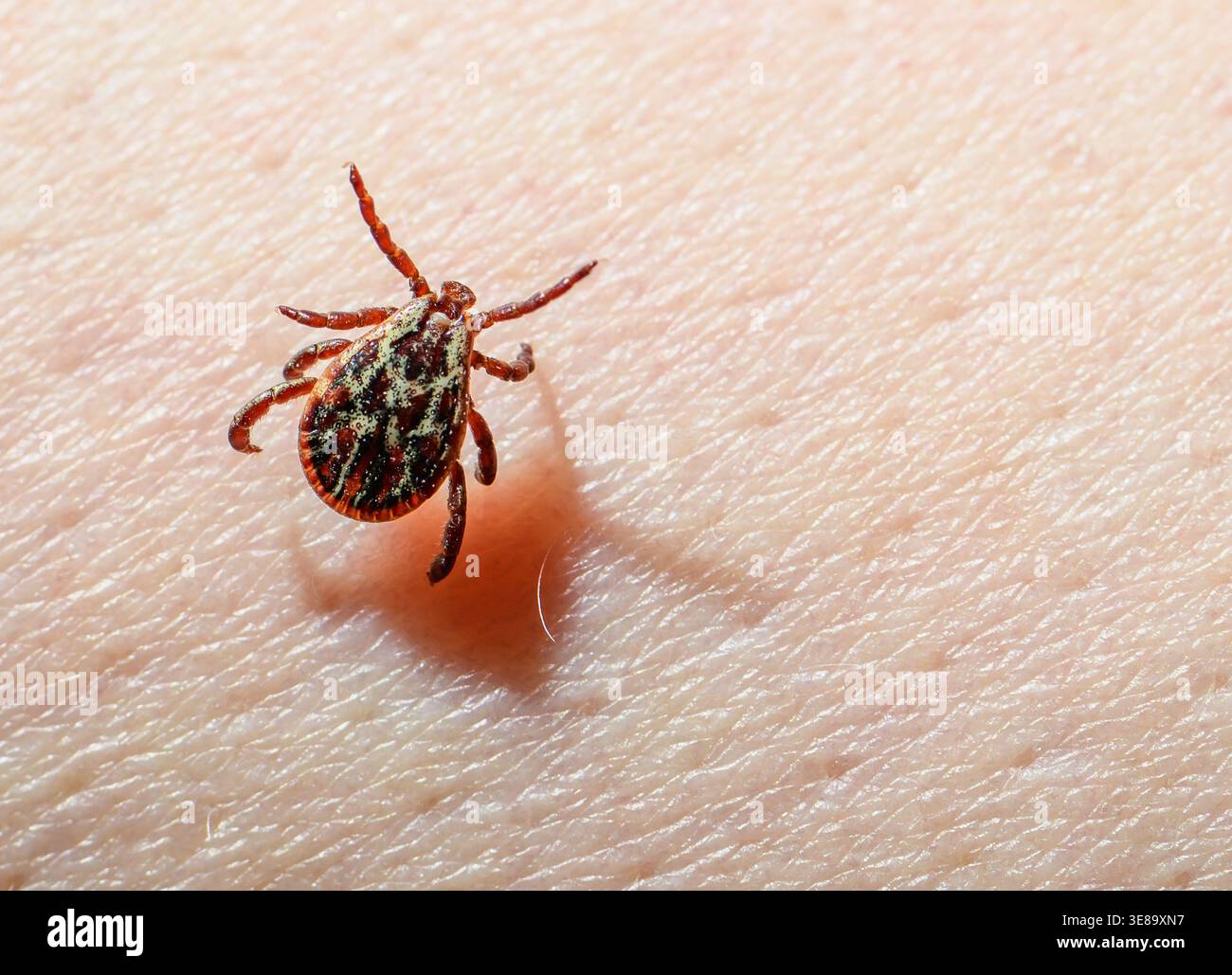 13 April 2026, Brandenburg, Sieversdorf: A meadow tick (Dermacentor ...