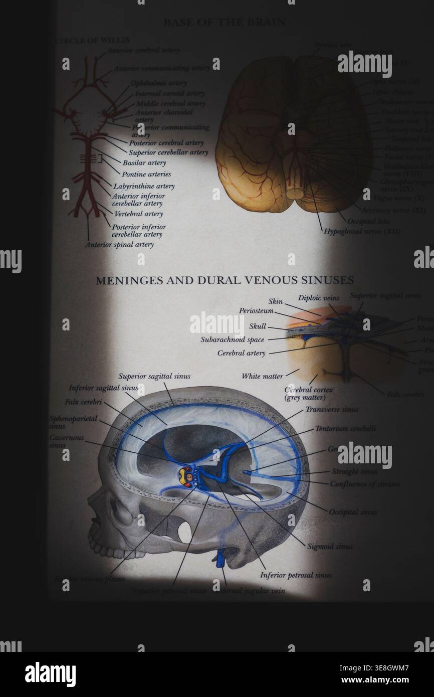 Medical diagram shows human brain anatomy. Skull cross-section highlights meninges and venous sinuses. Labels point to specific brain structures and v Stock Photo