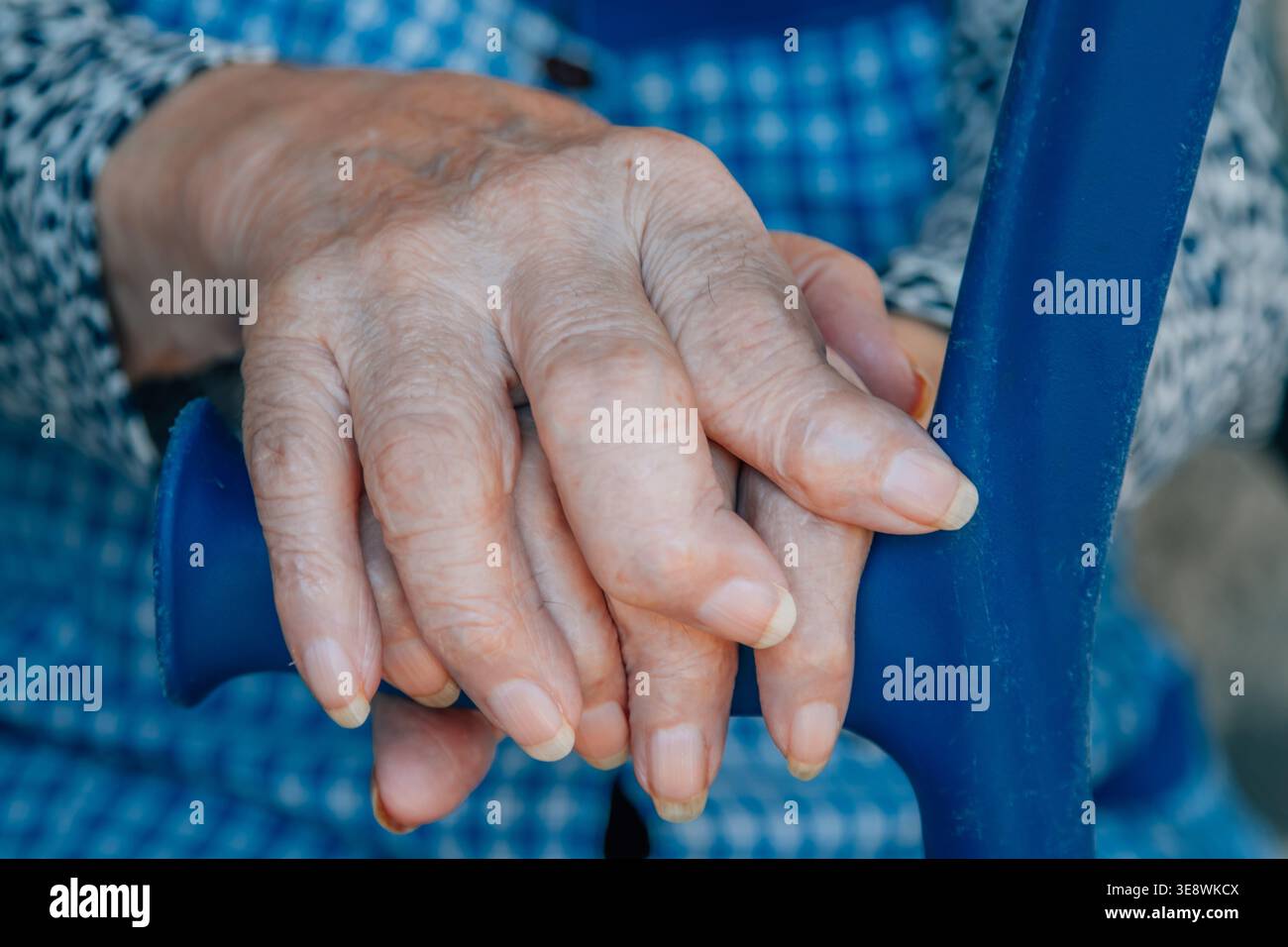 Swollen finger joints hi-res stock photography and images - Alamy