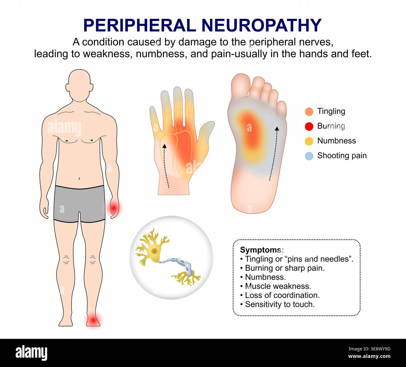 tirzepatide tingling feet Diabetic Neuropathy