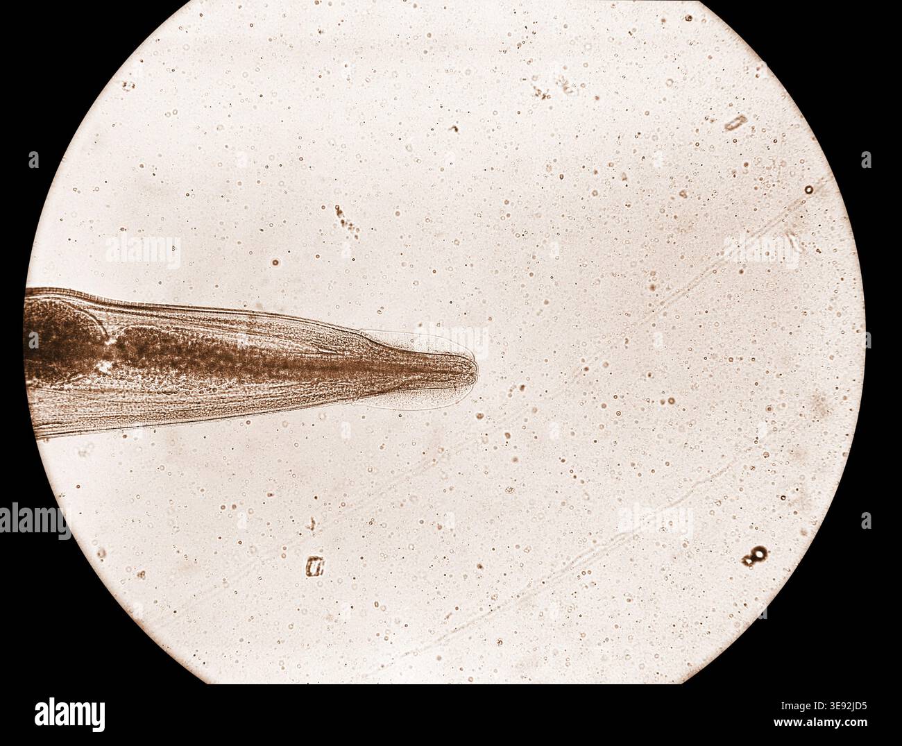 Enterobius hi-res stock photography and images - Alamy