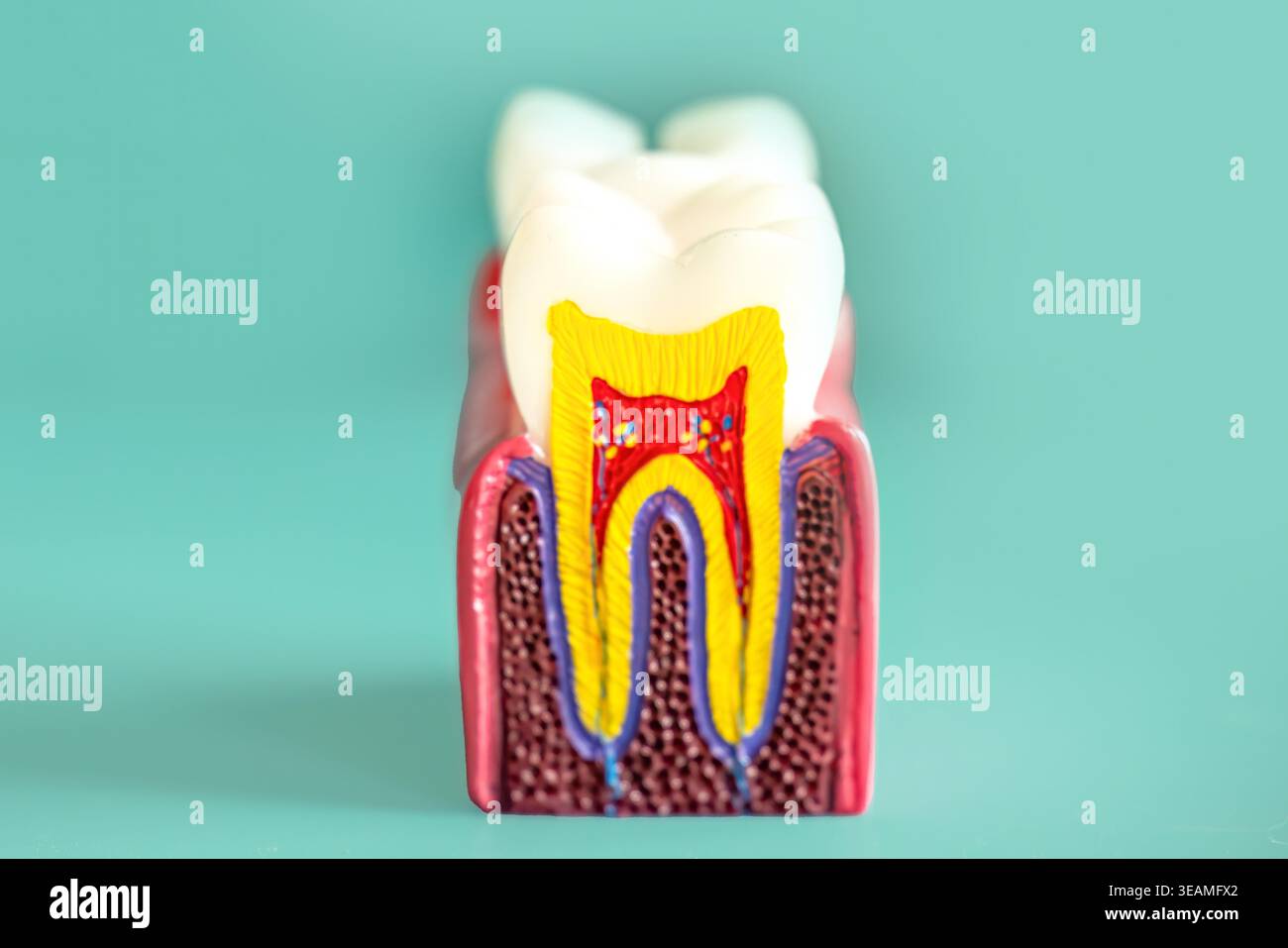Detailed dental model illustrating internal tooth layers enamel dentin ...
