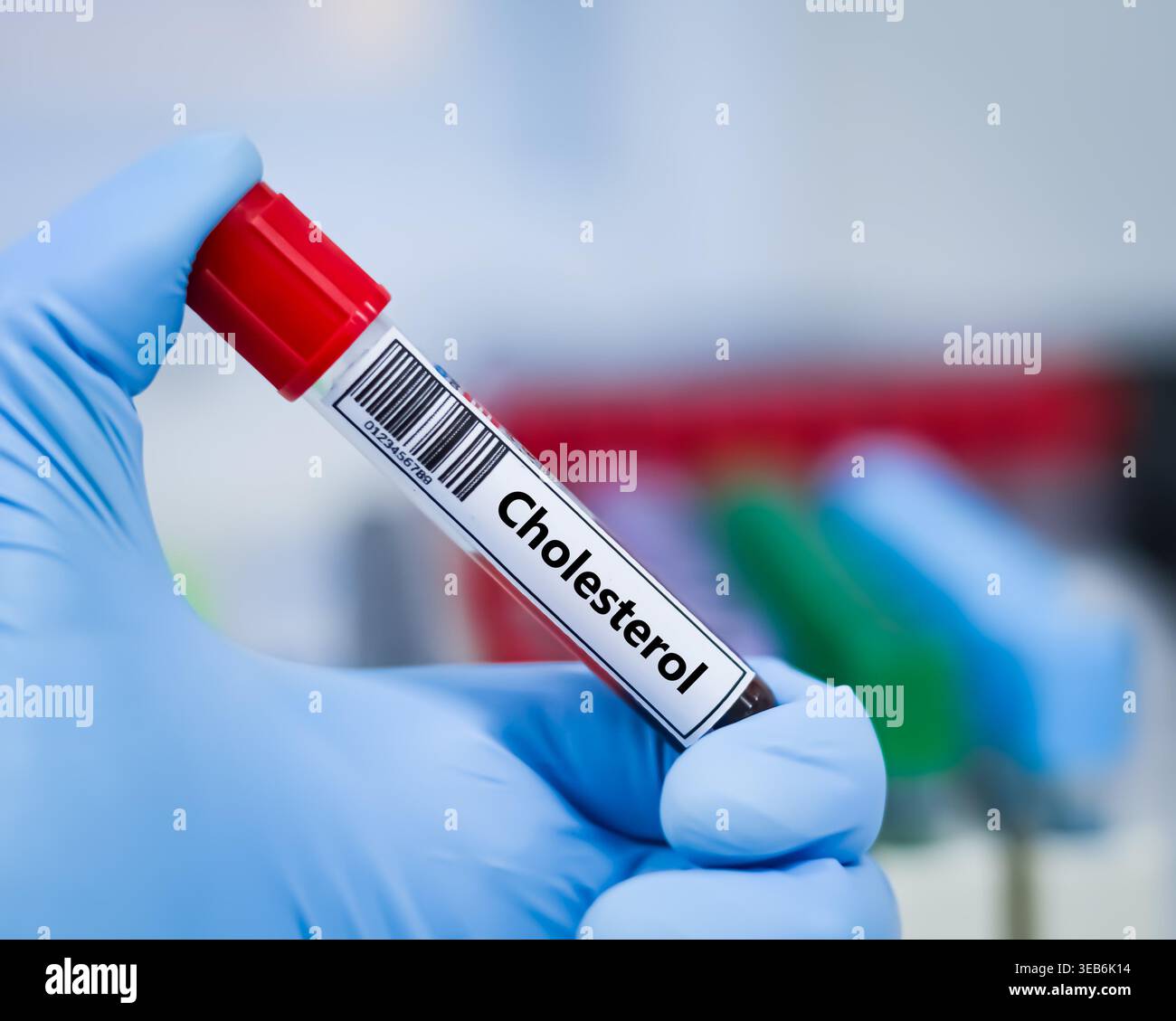 Ldl Test Tube Blood sample tube for cholesterol test analysis Stock Photo - Alamy