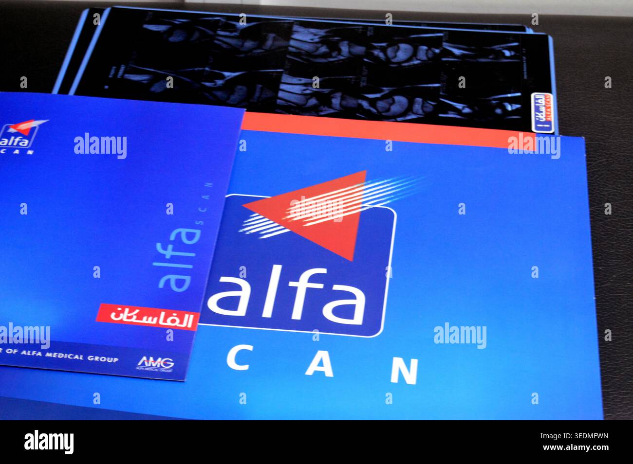 Cairo, Egypt, April 30 2026: radilogy scans and folders from Alfa Scan ...