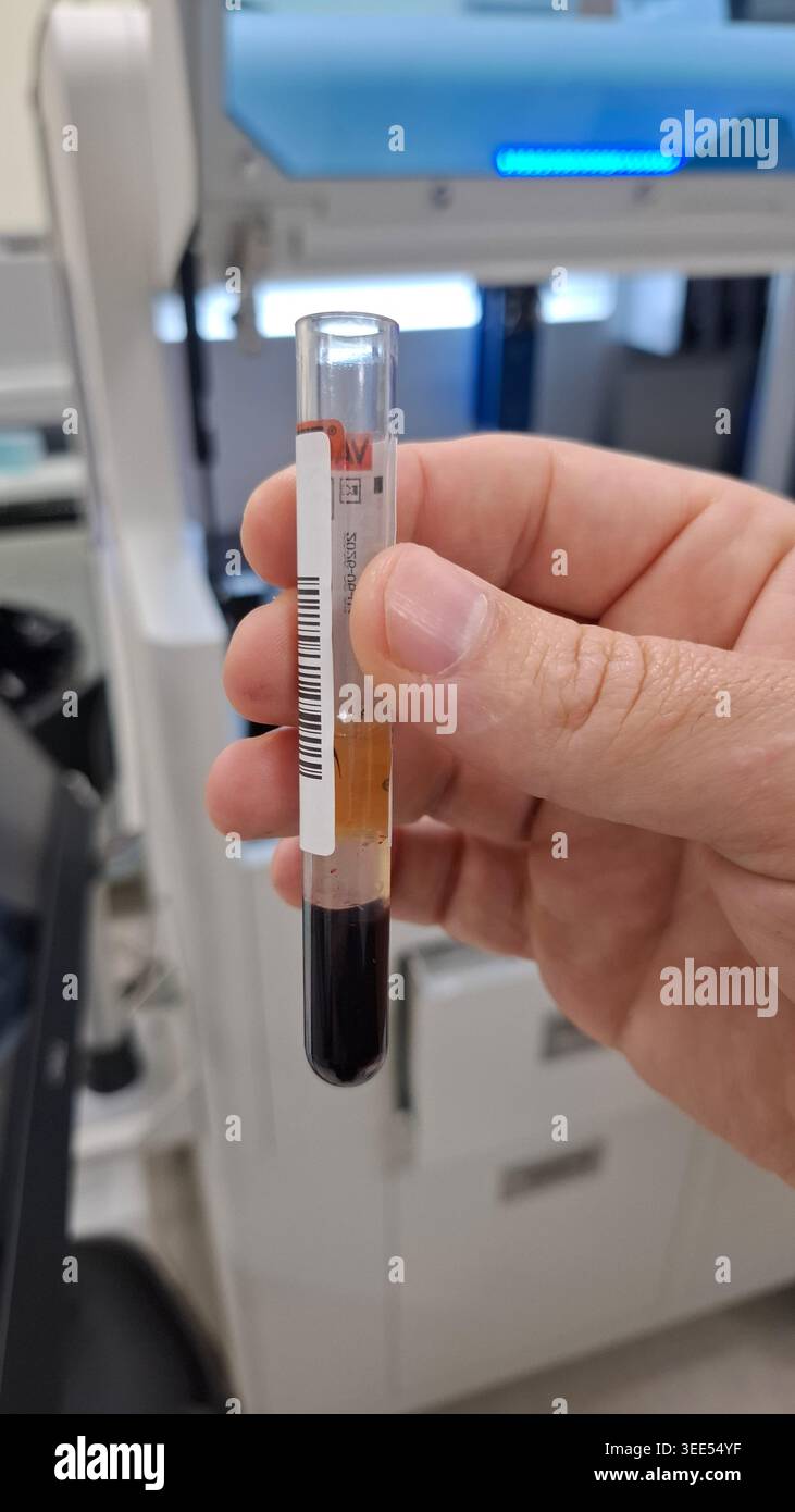 Centrifuged Blood Sample Close-up Stock Photo