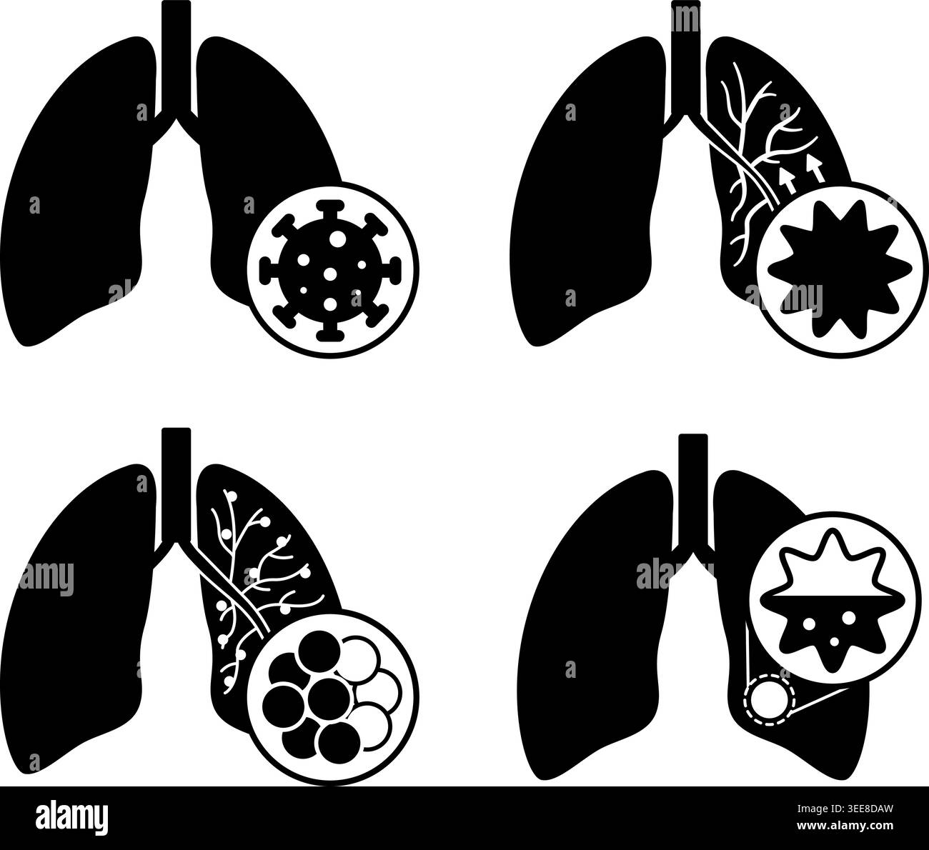 Black Icons of Lung Disease, Bronchitis, COPD, and Pneumonia. Vector ...