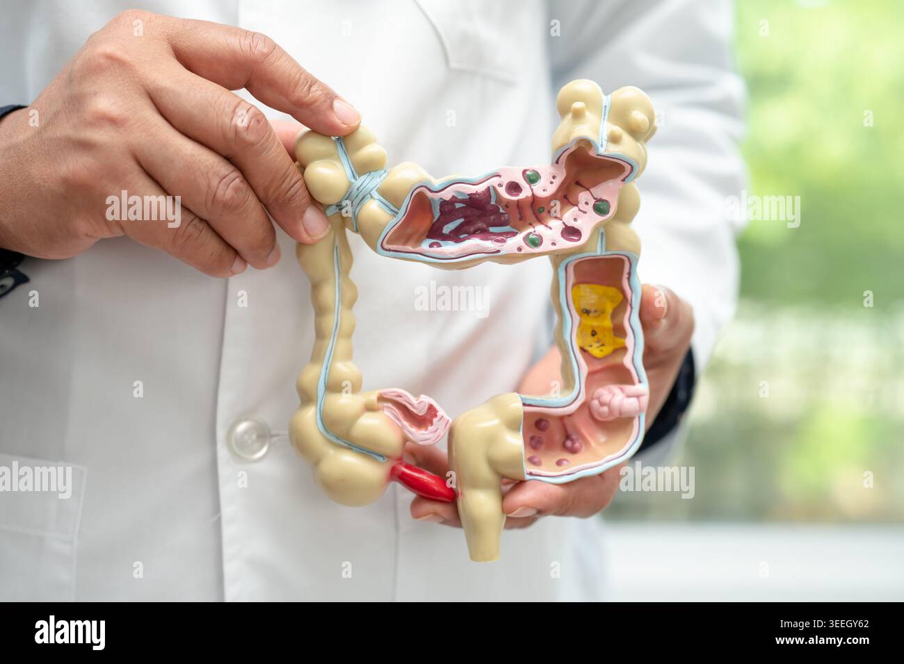 Intestine, appendix and digestive system, doctor holding anatomy model ...