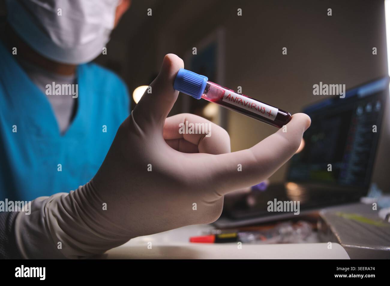 Scientist analyzing antavirus positive blood sample in a research laboratory setting Stock Photo