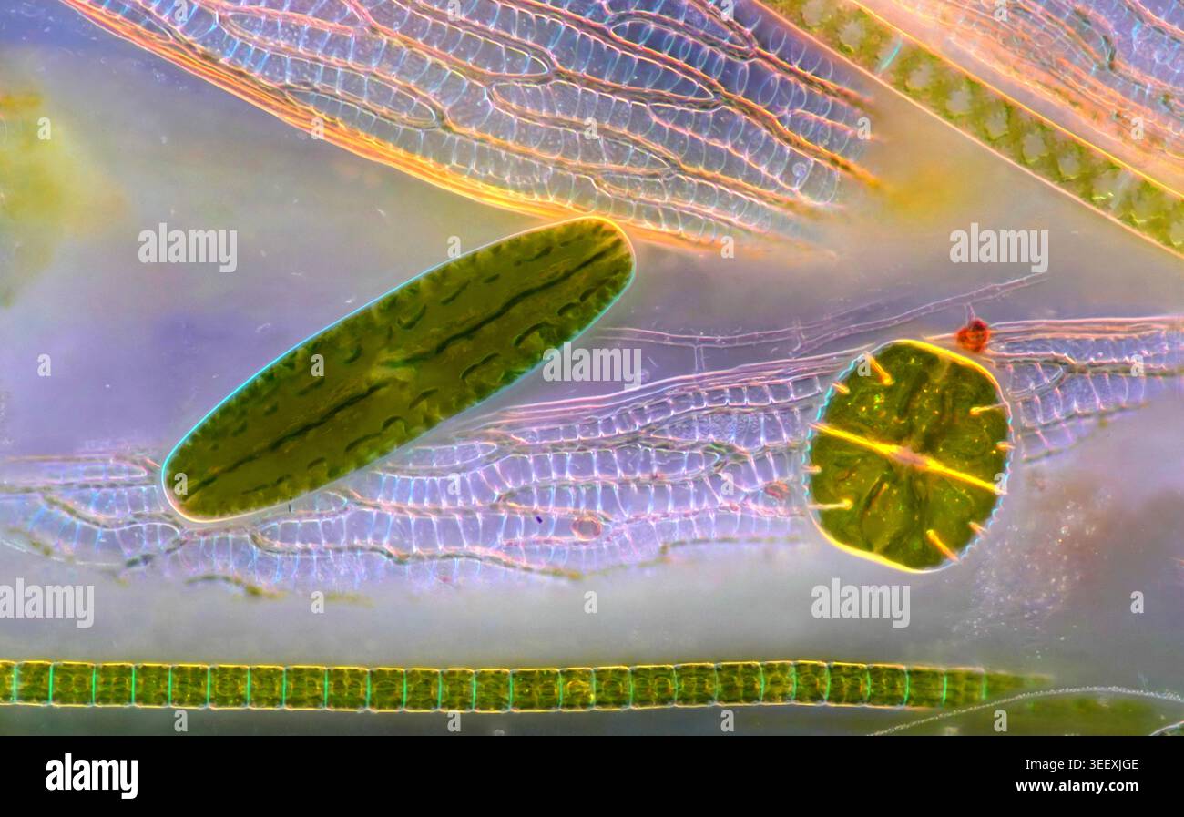 Netrium Sp Polarised light micrograph of a Netrium sp. desmid and a Micrasterias ...