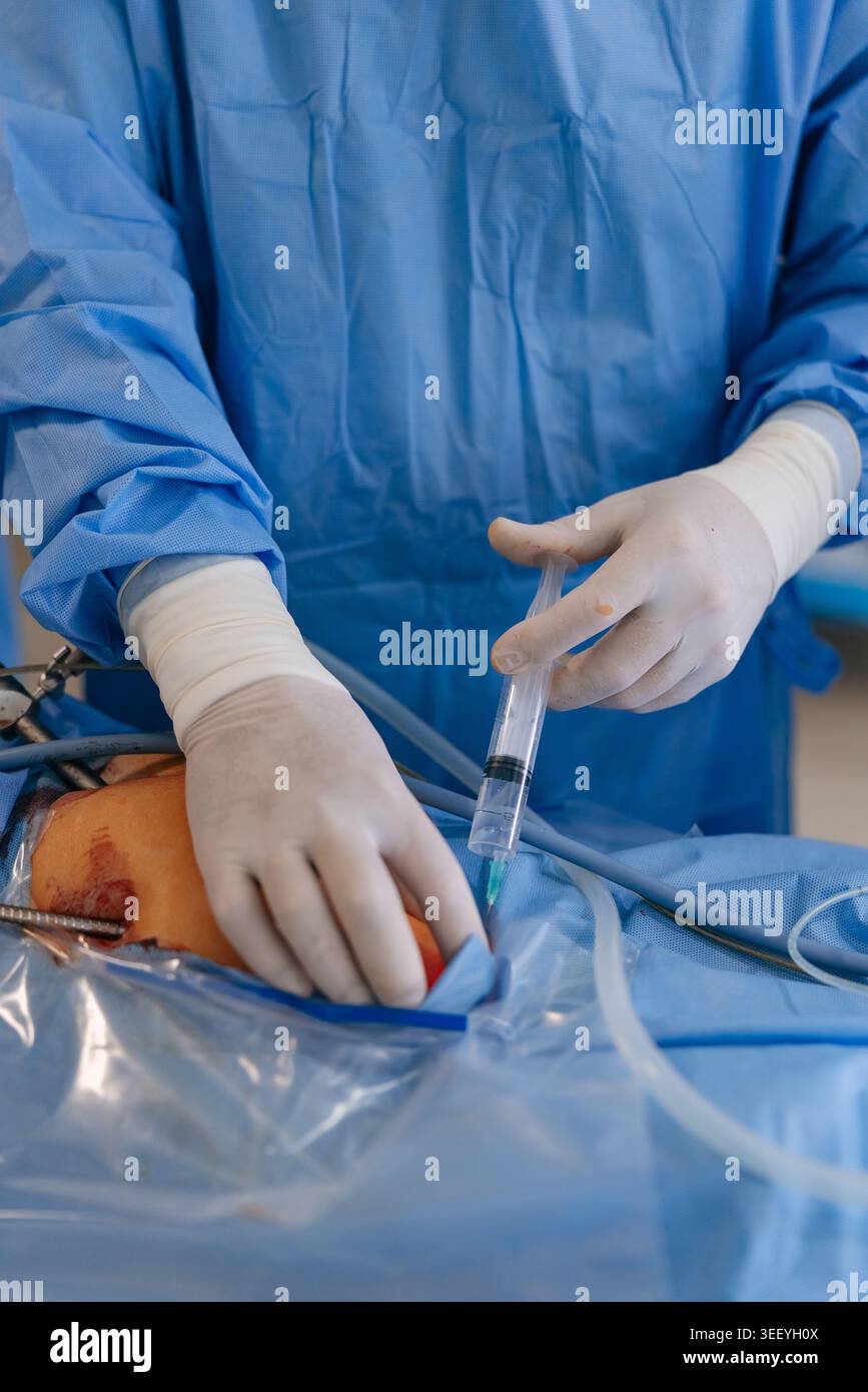Pat Mac Injection Close-up of surgeon in sterile gloves and blue gown performing local ...