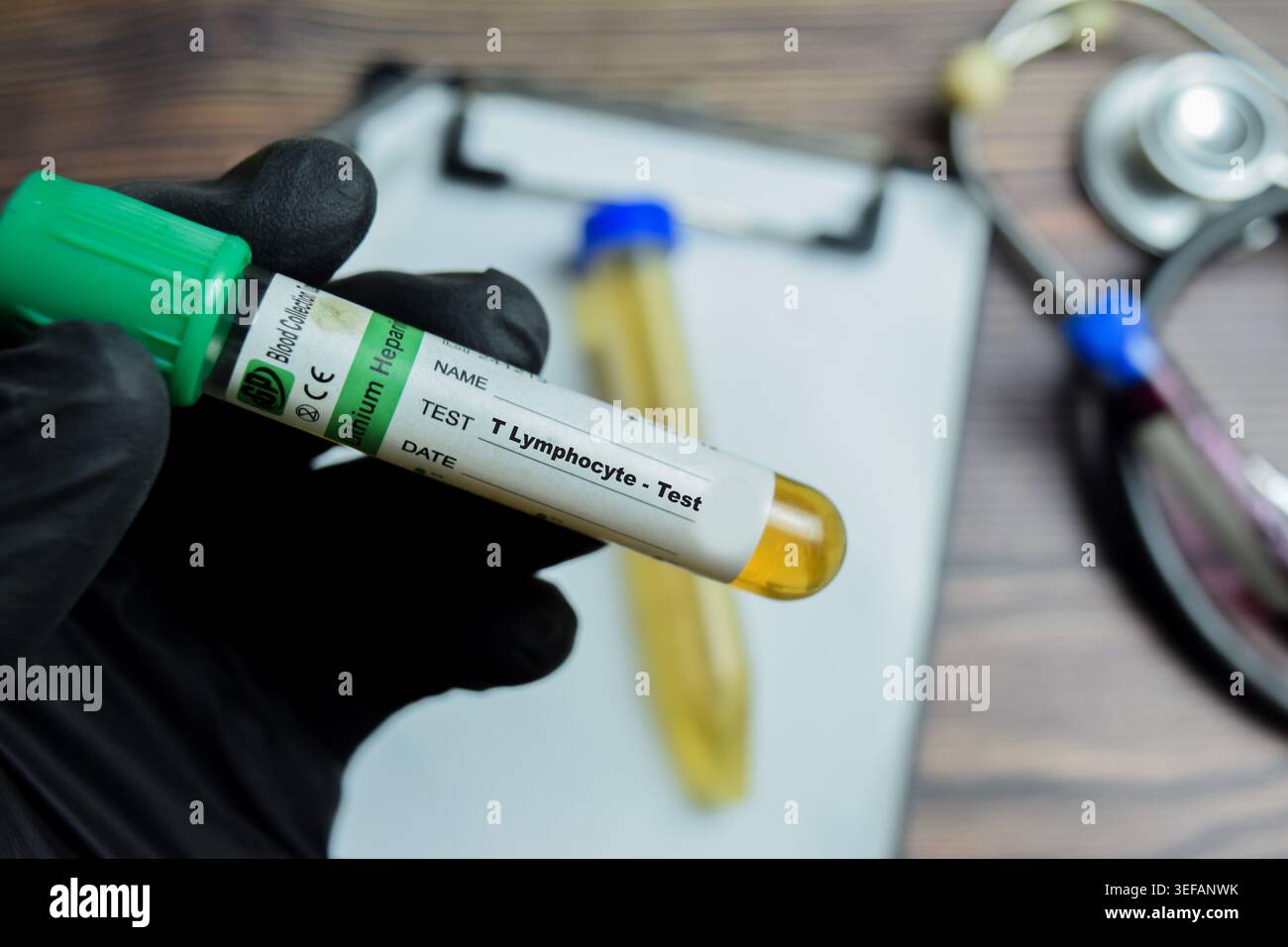 Cd4 test hi-res stock photography and images - Alamy