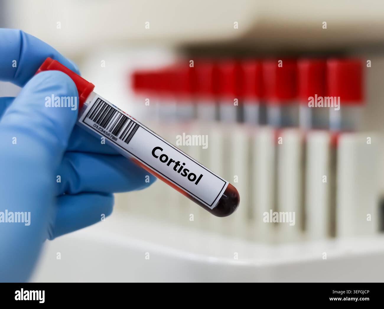 Blood sample tube for cortisol test analysis Stock Photo - Alamy