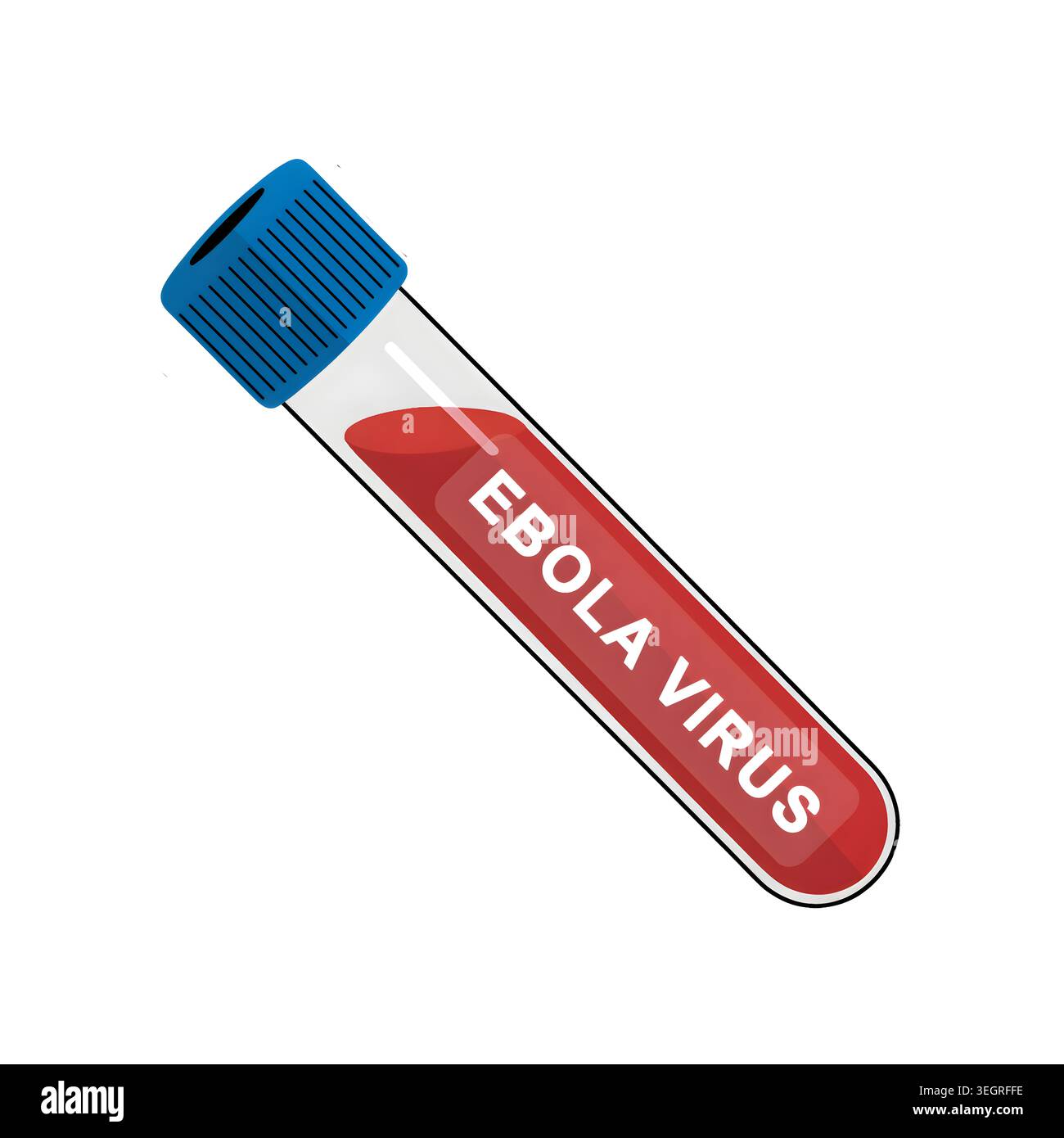 Ebola Virus Blood Sample in Test Tube, Medical Laboratory Illustration ...