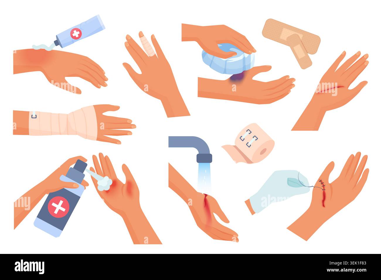 Collection of hand injury care scenes with cream, bandage, ice, plaster ...