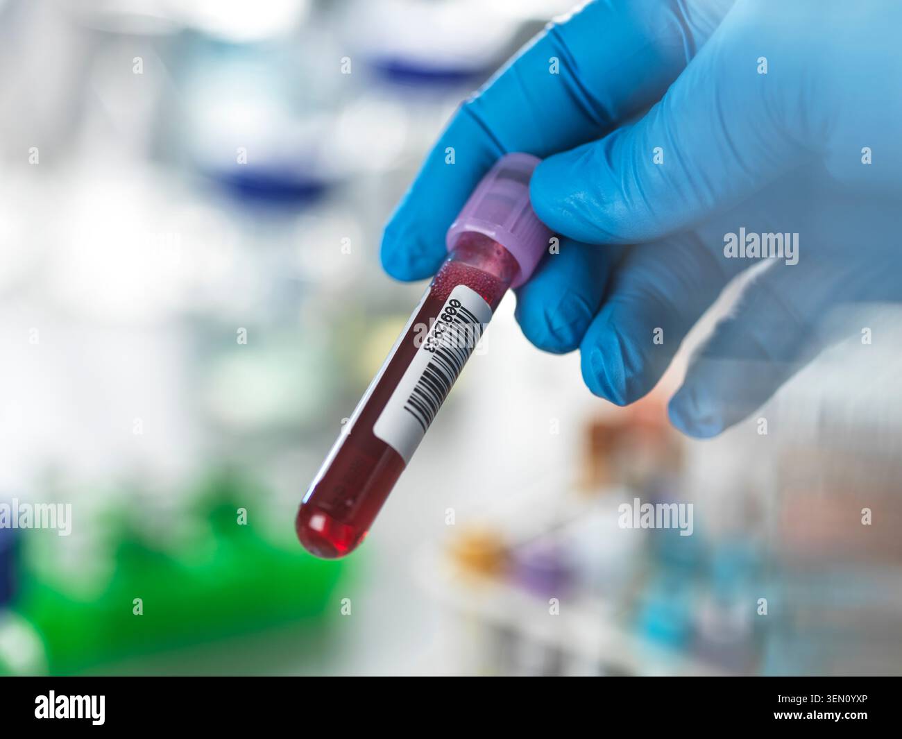 Gloved hand holding a blood sample vial with a barcode in a laboratory ...