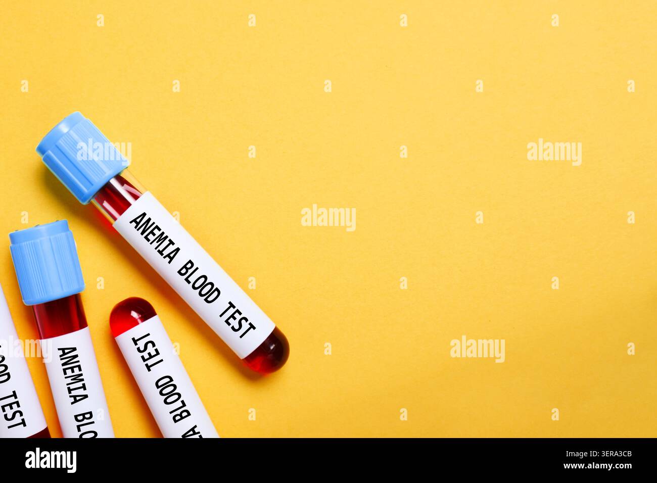 Hospital lab test labels hi-res stock photography and images - Alamy