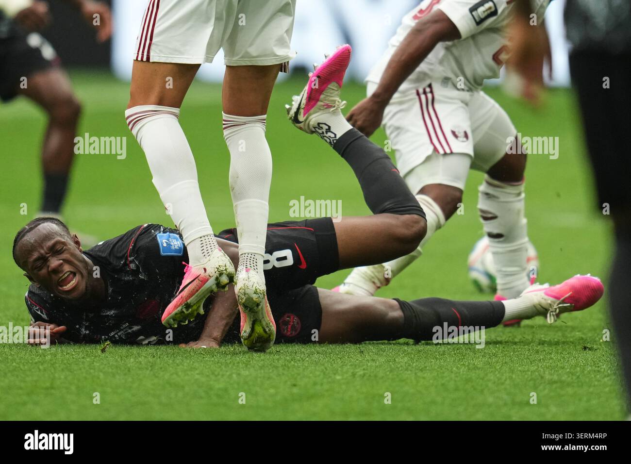 Canada's Ismael Kone falls while sustaining an injury during the World ...