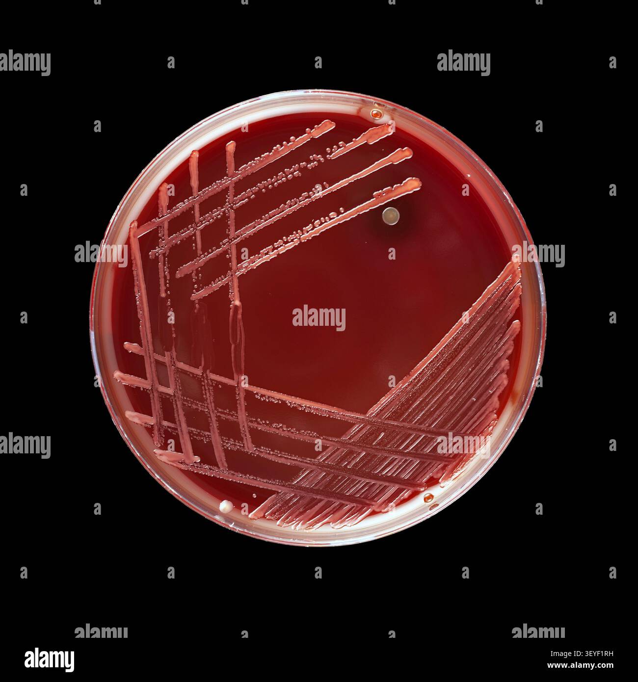 Accidental Contamination in Streaked Agar Stock Photo