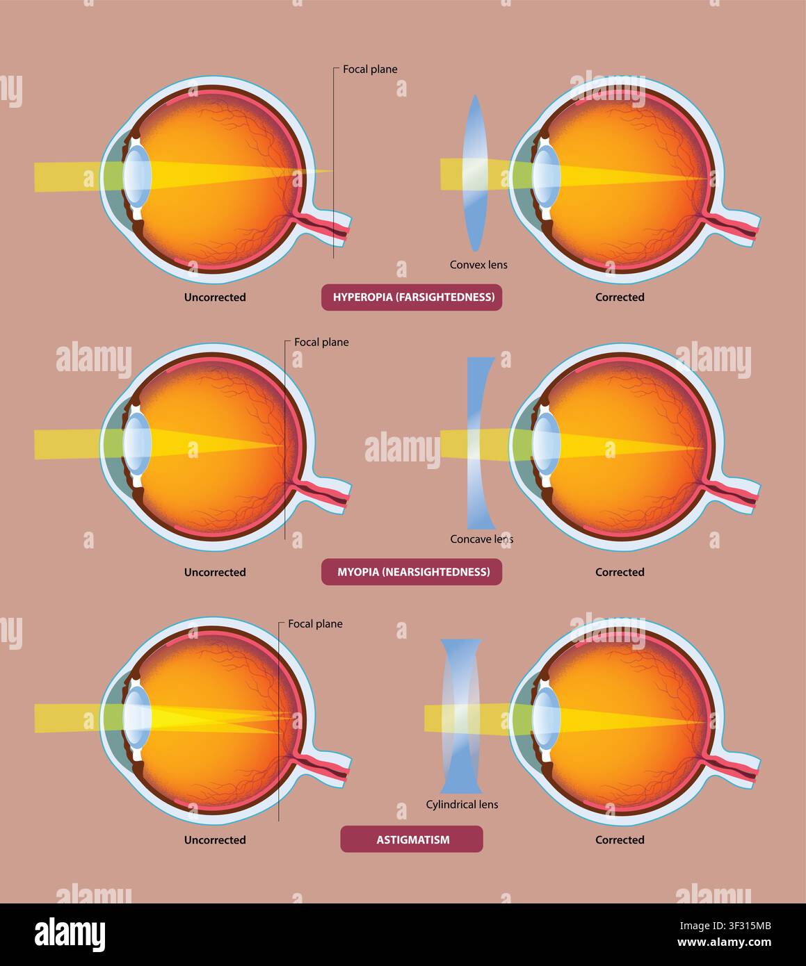 Diagram concave convex lens Stock Vector Images - Alamy