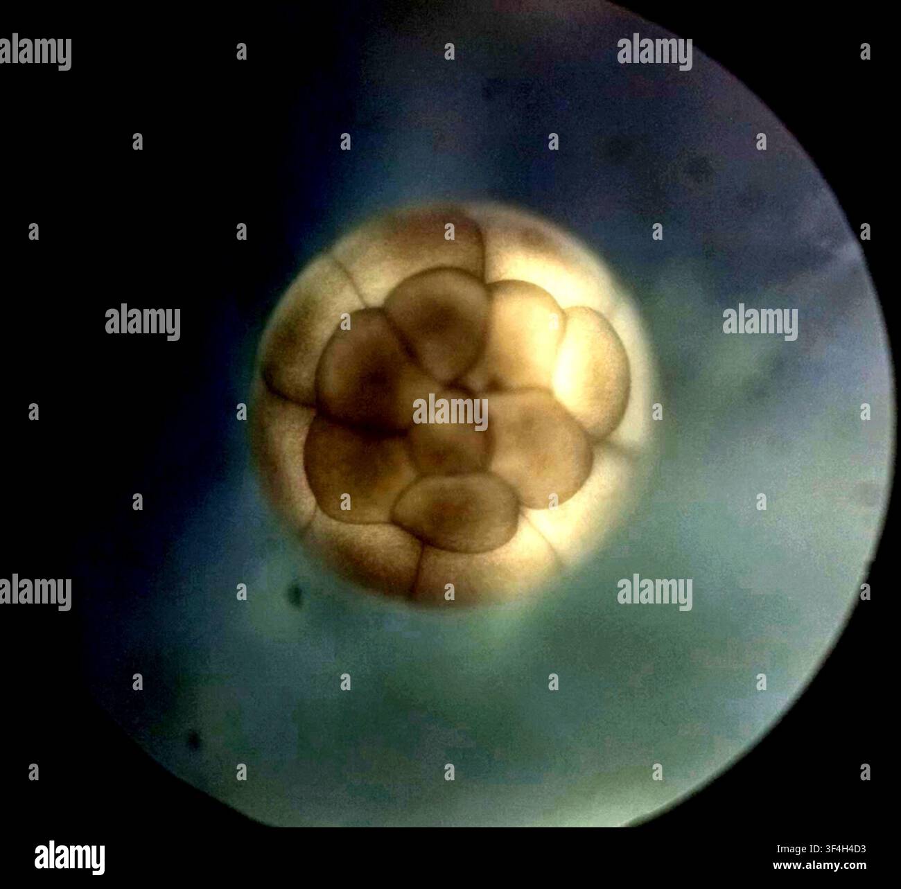Light Micrograph Of An Axolotl Ambystoma Mexicanum Embryo At The light-micrograph-of-an-axolotl-ambystoma-mexicanum-embryo-at-the