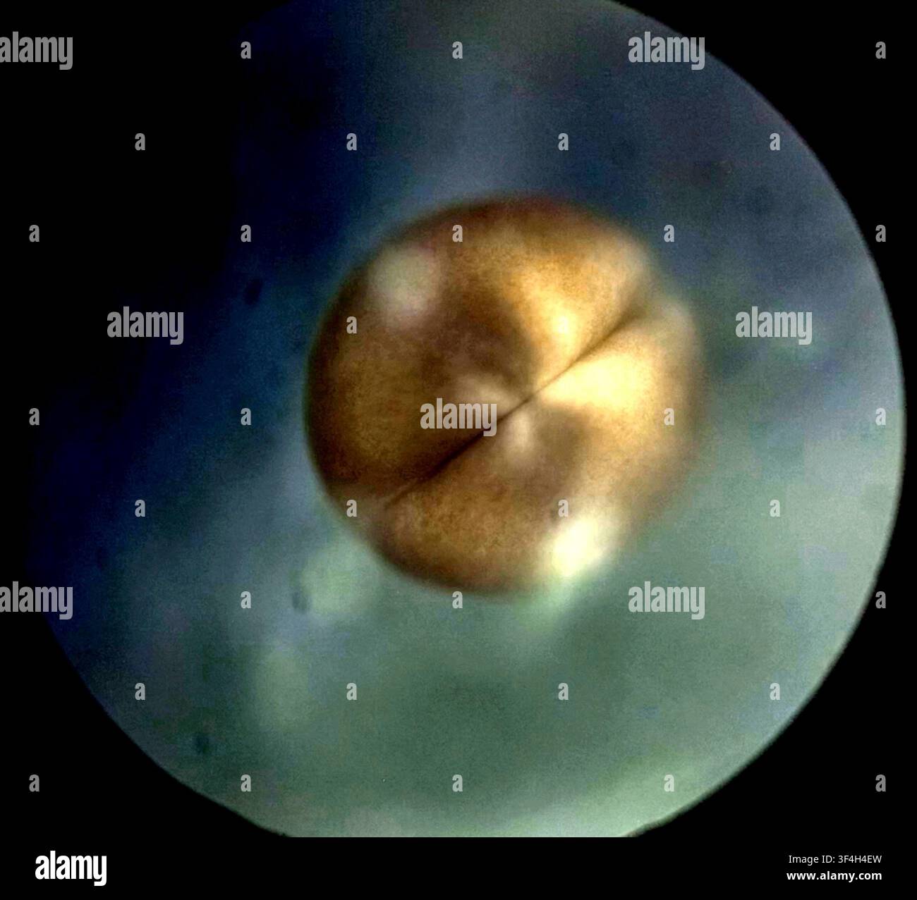 Light Micrograph Of A Two Cell Axolotl Ambystoma Mexicanum Embryo light-micrograph-of-a-two-cell-axolotl-ambystoma-mexicanum-embryo