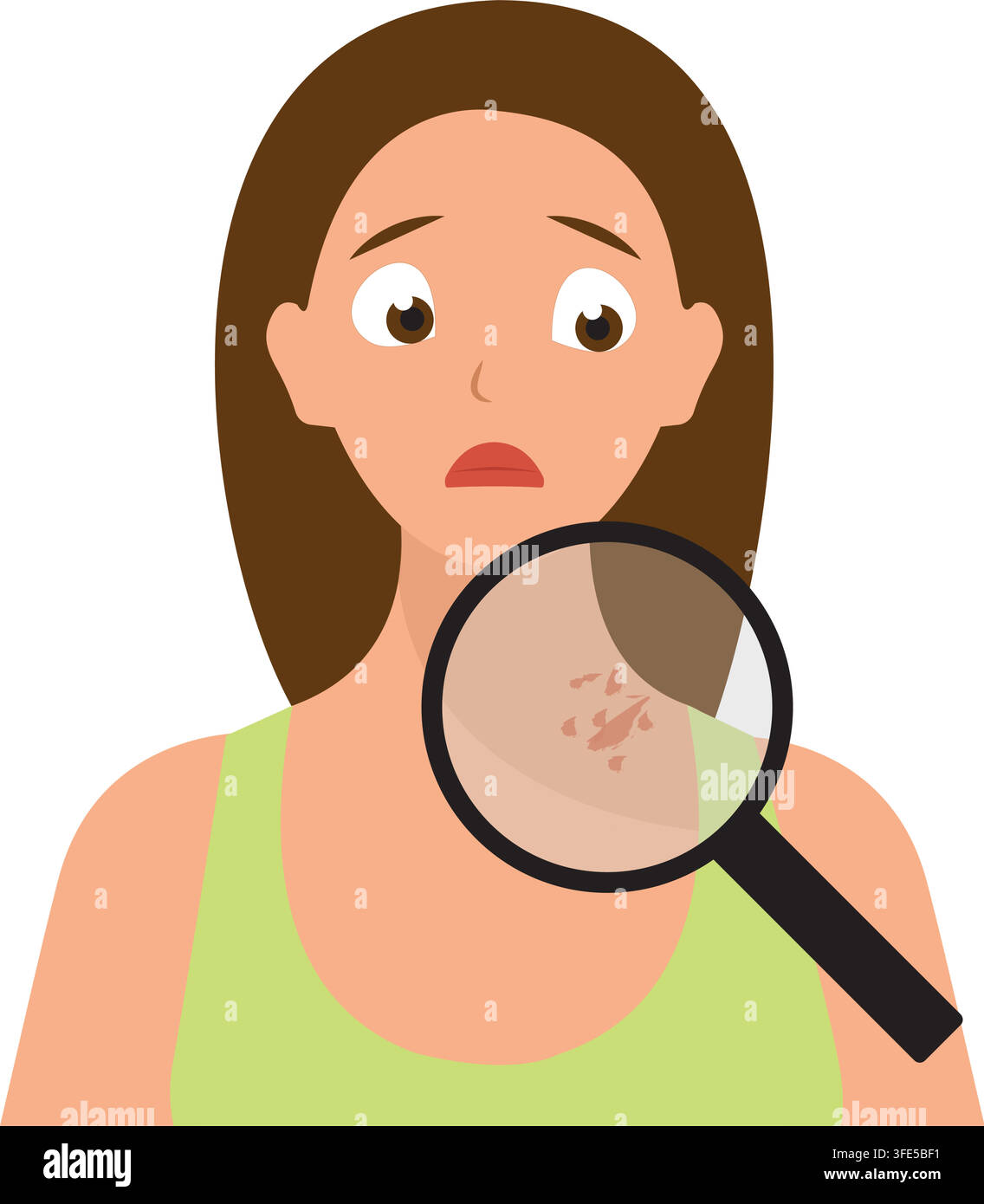 Worried Woman Checking Shingles Rash on Neck with Magnifying Glass Vector. Stock Vector