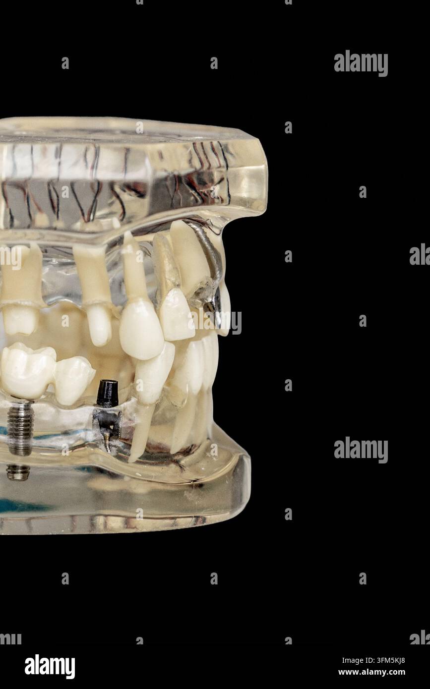 Dental jaw model displays hi-res stock photography and images - Alamy