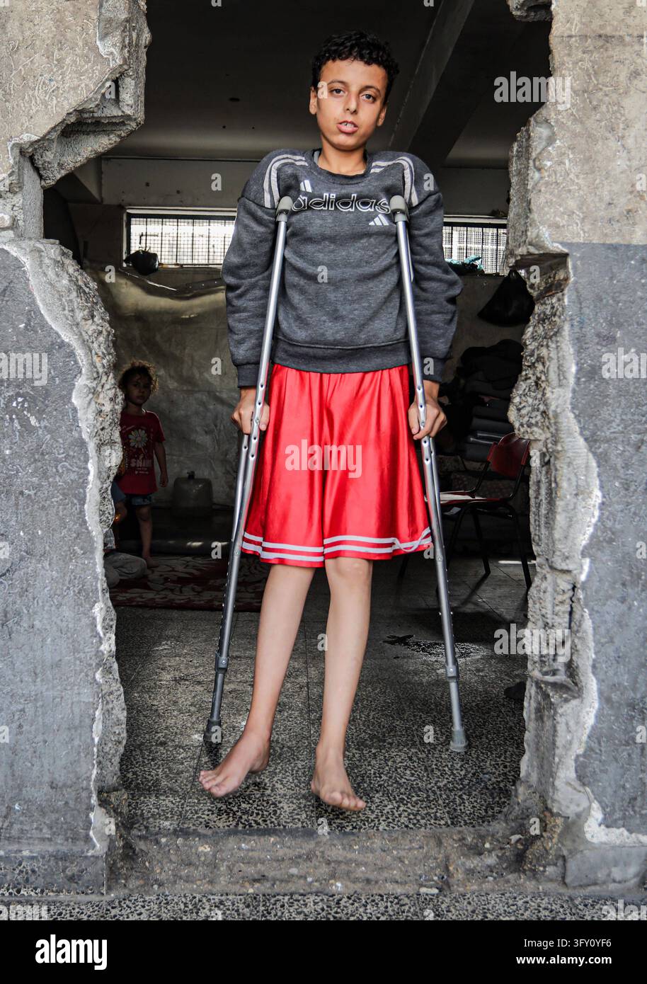 Palestinian Plate Palestinian Boy Who Lost Family in Israeli Strike Awaits Treatment ...