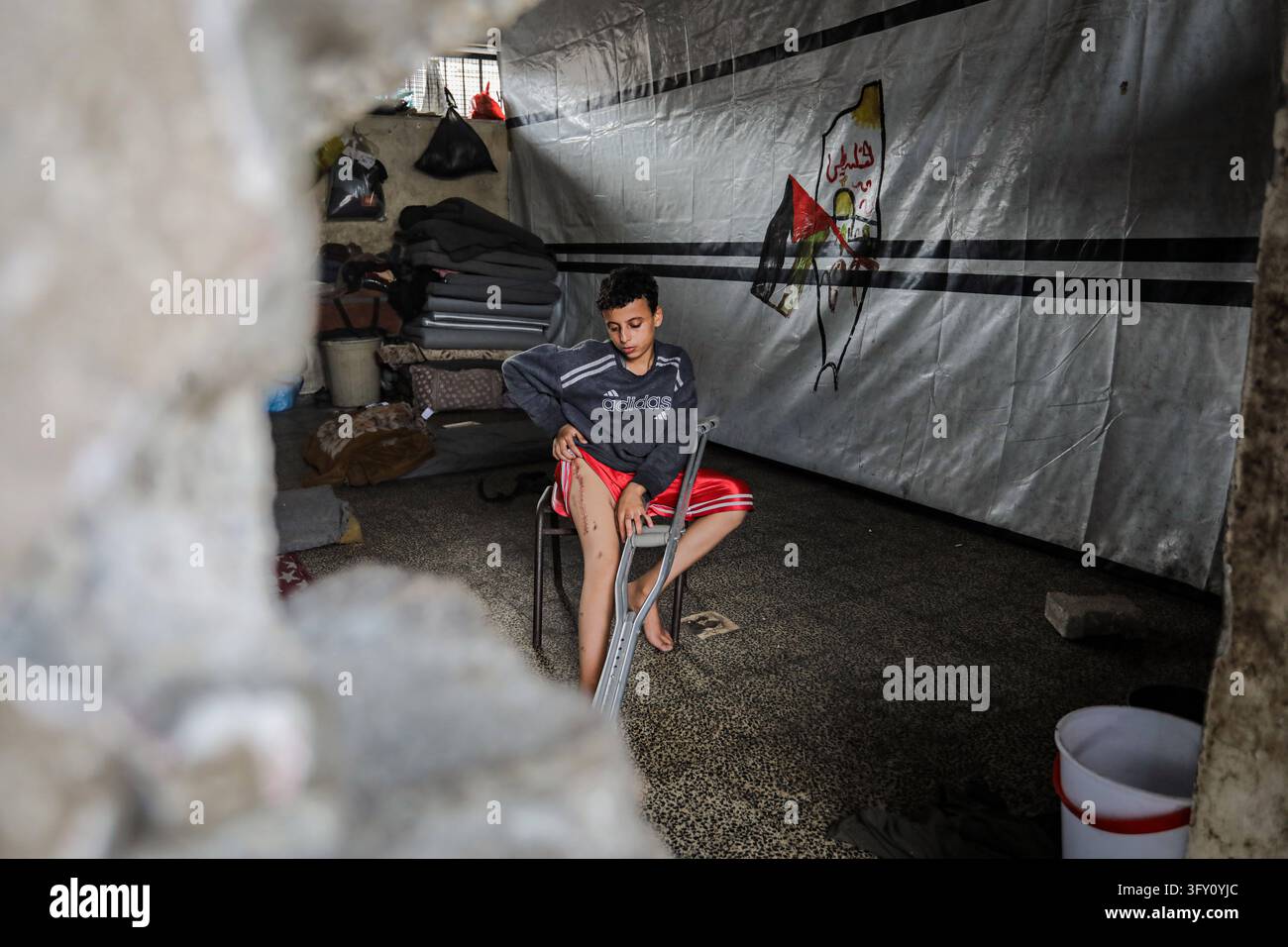 Palestinian Plate Palestinian Boy Who Lost Family in Israeli Strike Awaits Treatment ...