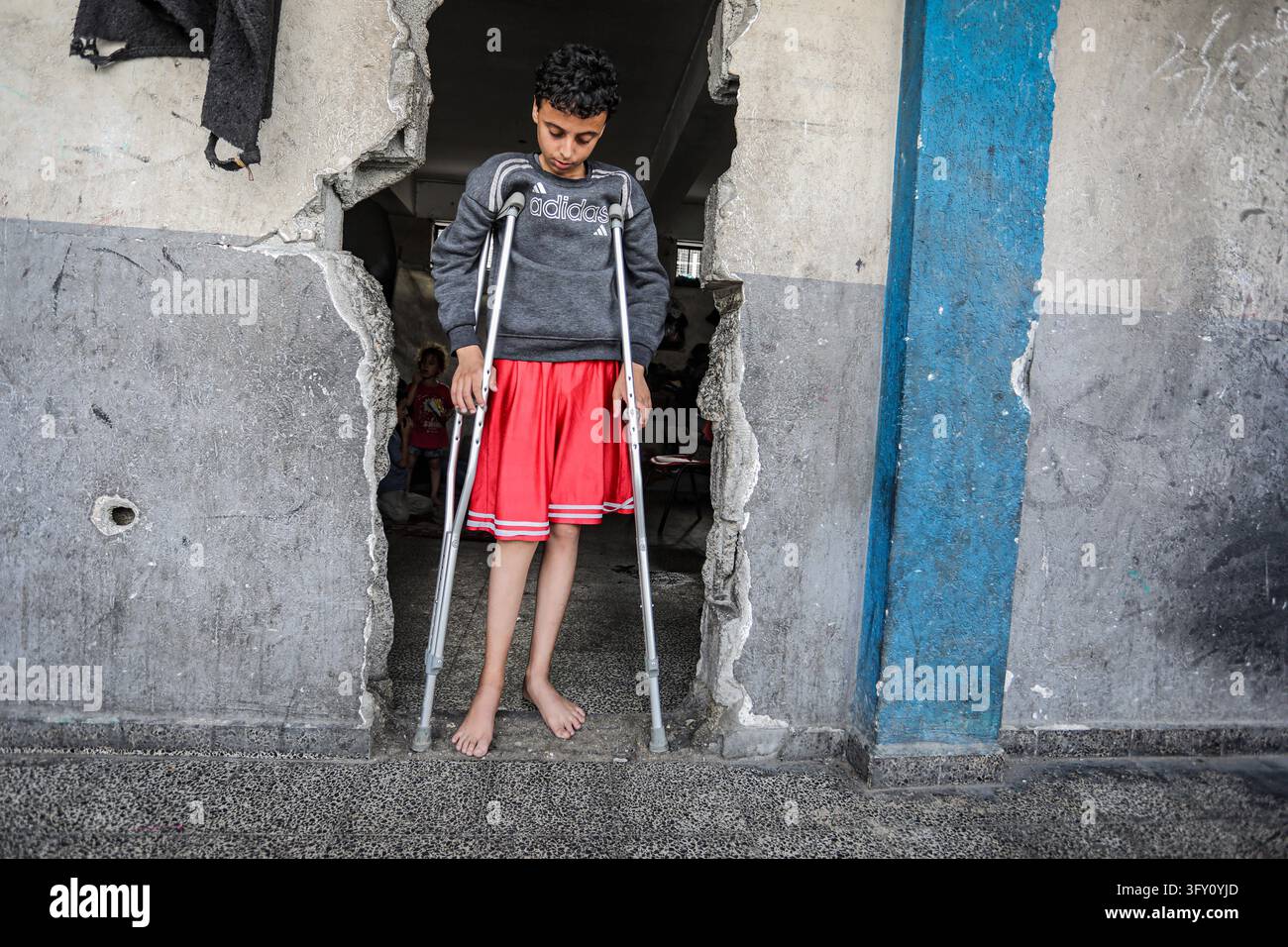 Palestinian Plate Palestinian Boy Who Lost Family in Israeli Strike Awaits Treatment ...